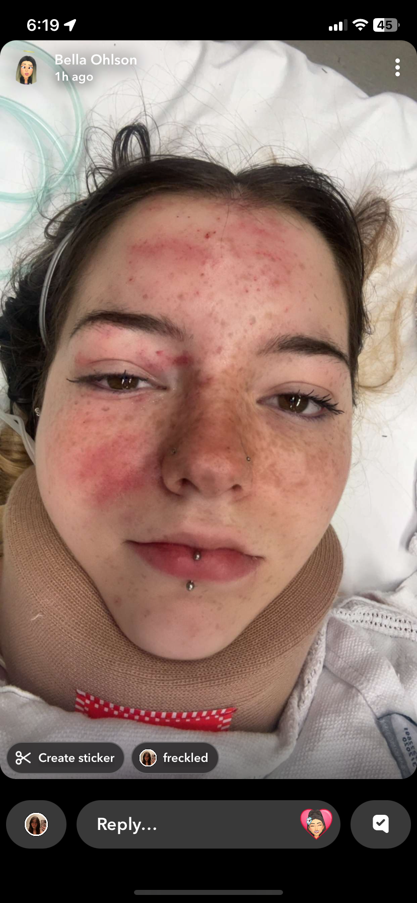 Help Bella recover from a traumatic injury campaign photo, 4 of 8