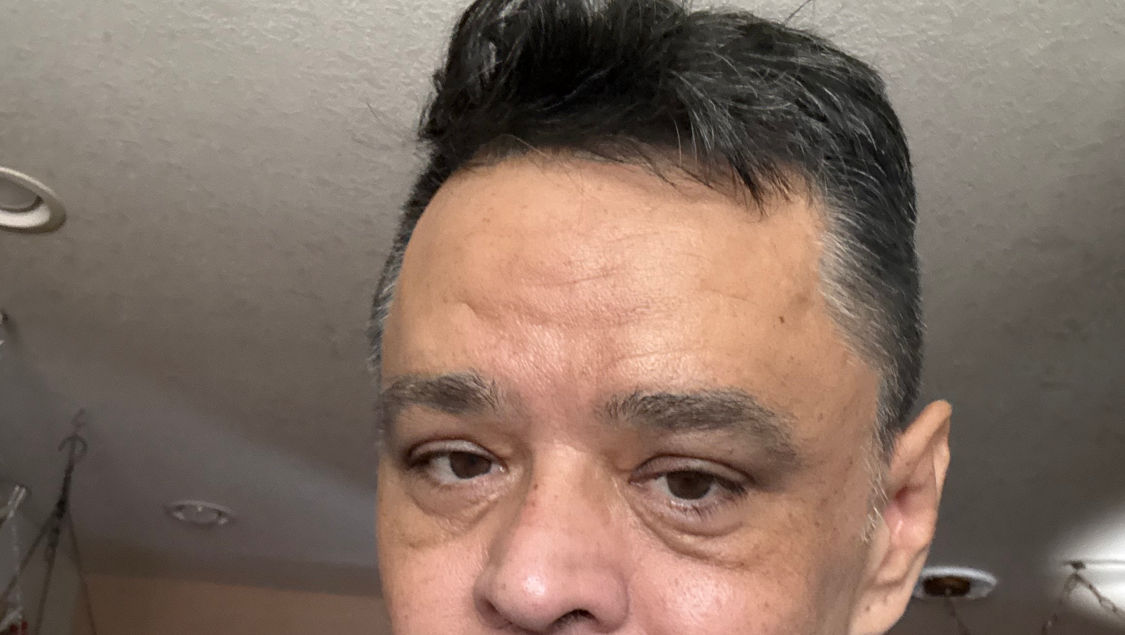 Derrick's Journey: Healing After Amputations