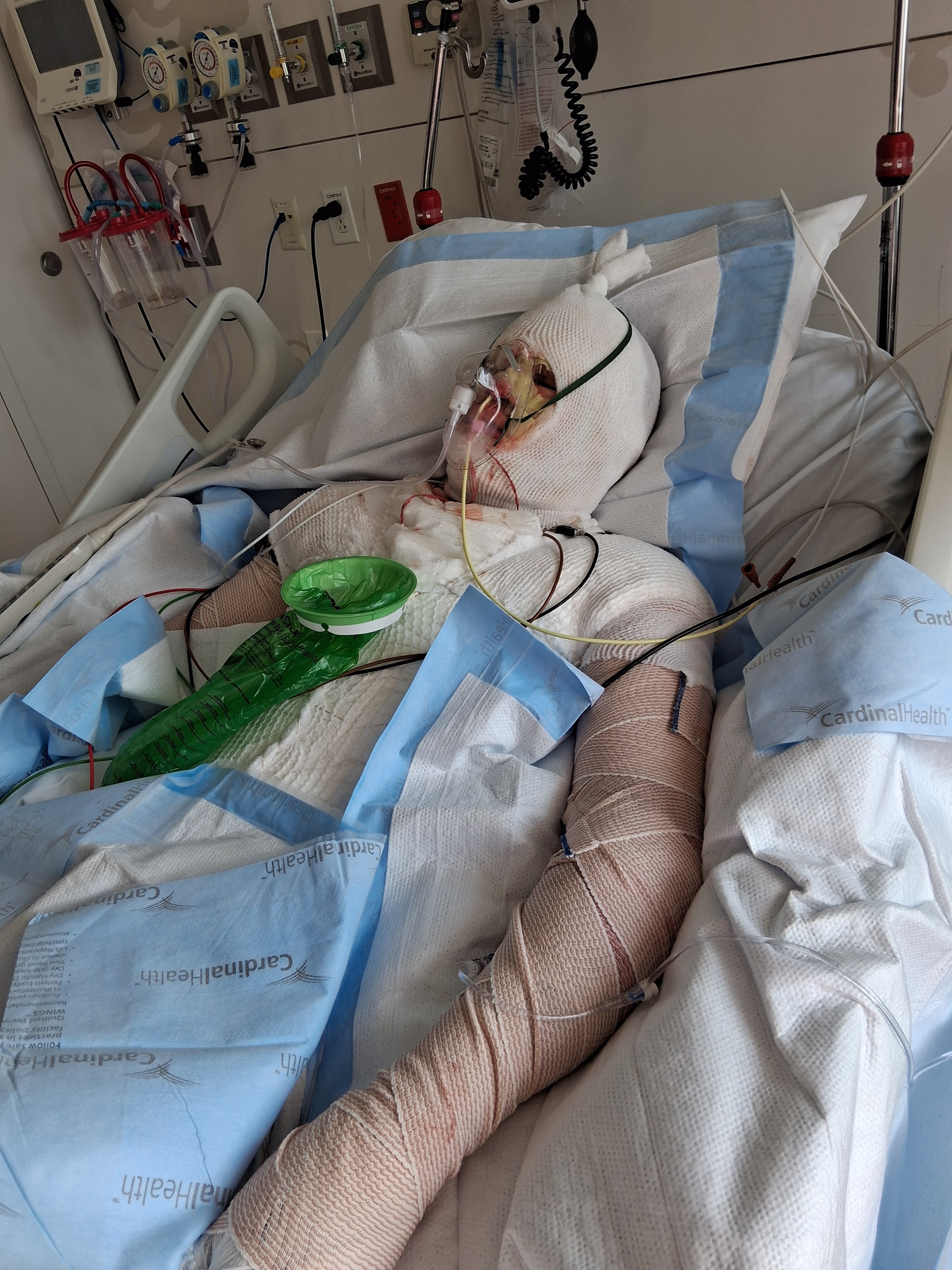 Help Stacy's Family Recover After Fire campaign photo, 2 of 4