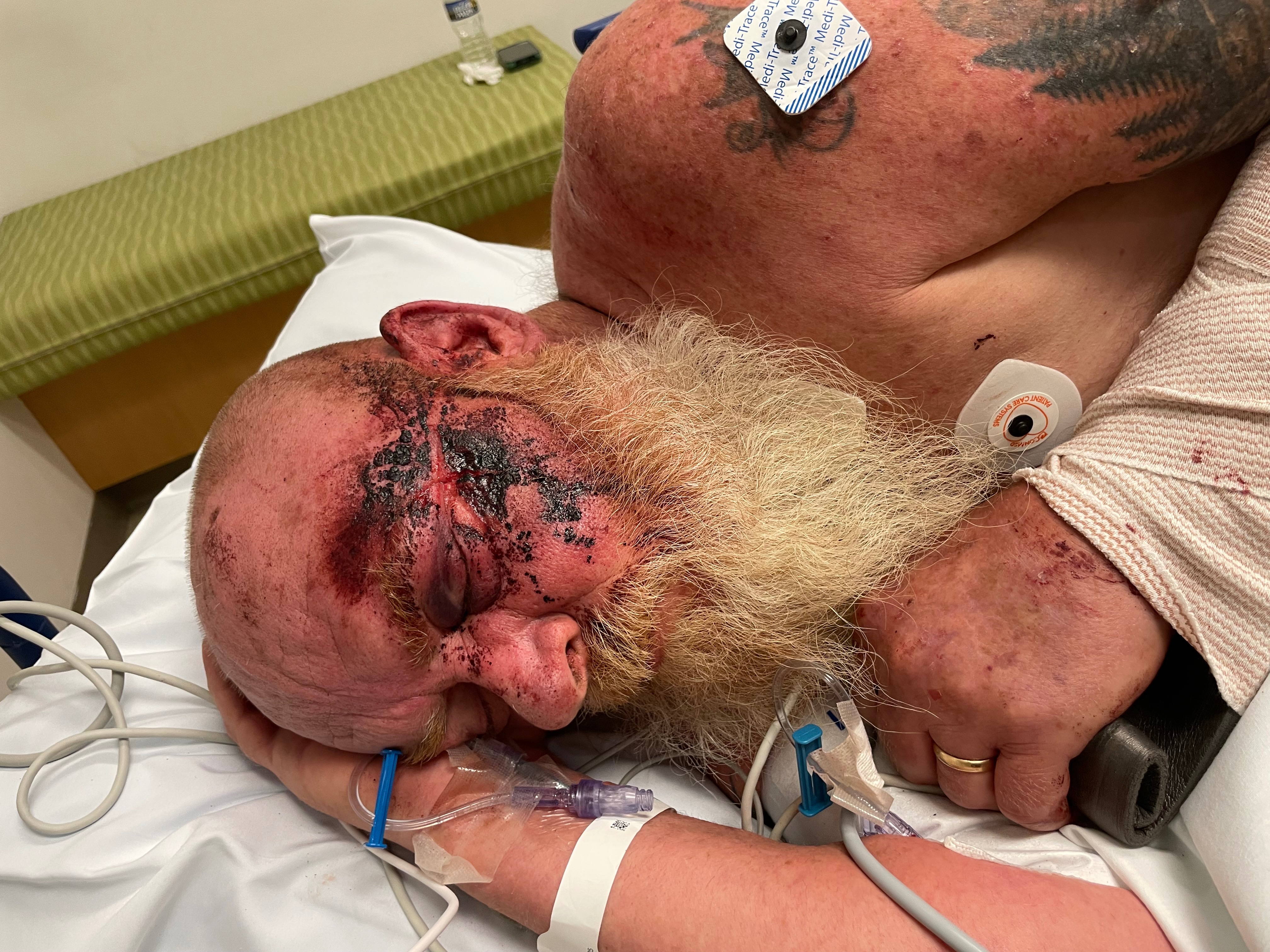 Aid Robert Kirchner's Medical Expenses campaign photo, 7 of 8