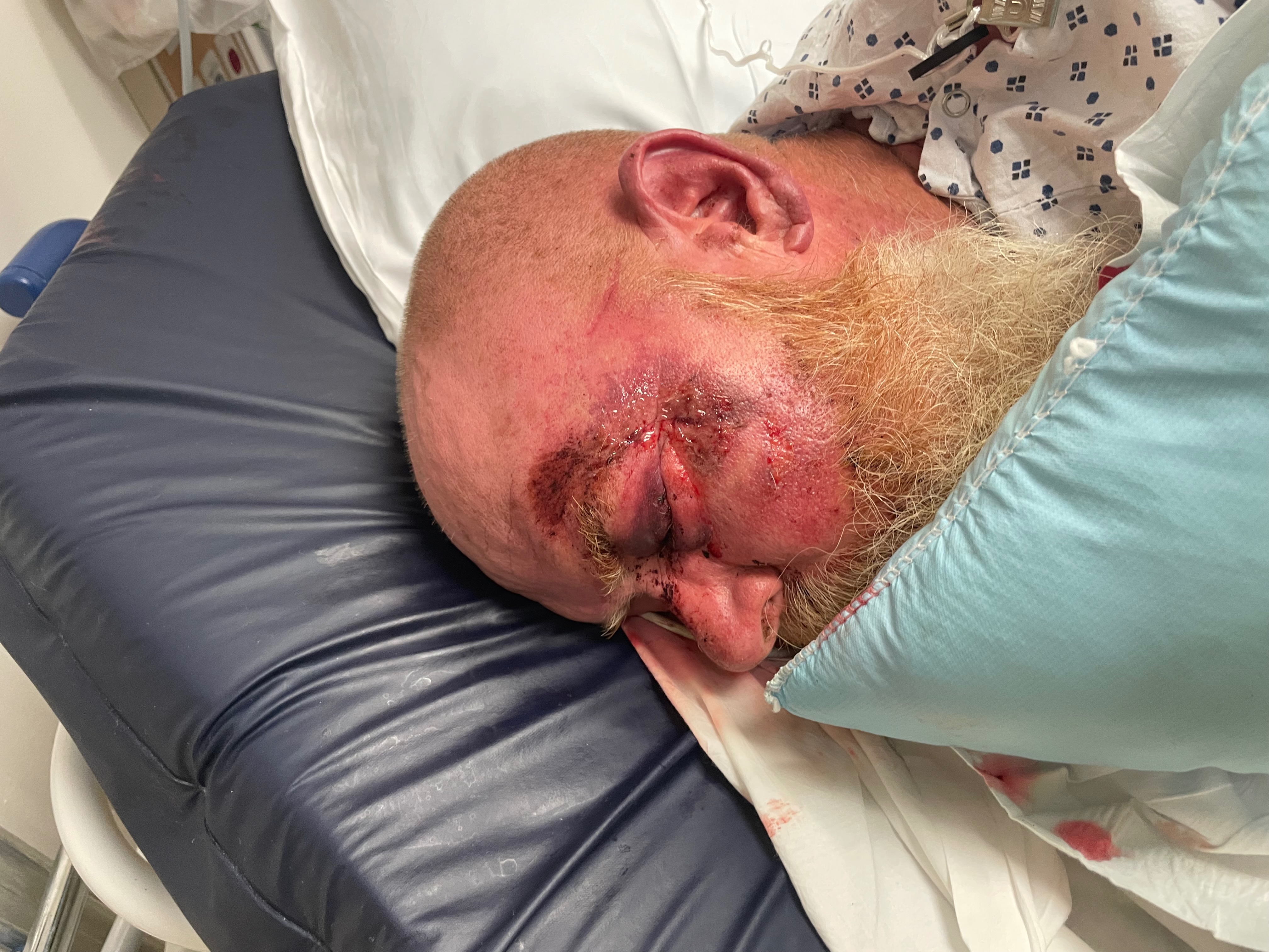 Aid Robert Kirchner's Medical Expenses campaign photo, 4 of 8