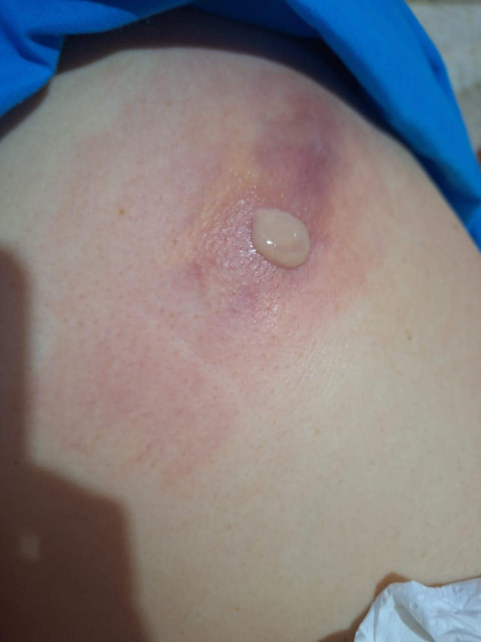 Sick woman needs help, my trial was at best I could've done campaign photo, 2 of 8