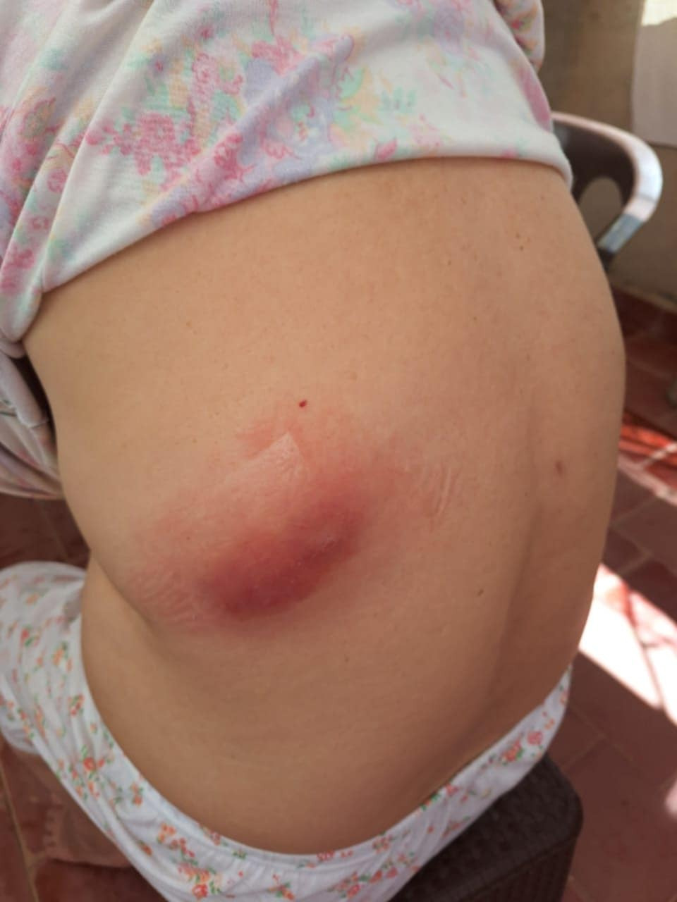 Sick woman needs help, my trial was at best I could've done campaign photo, 5 of 8