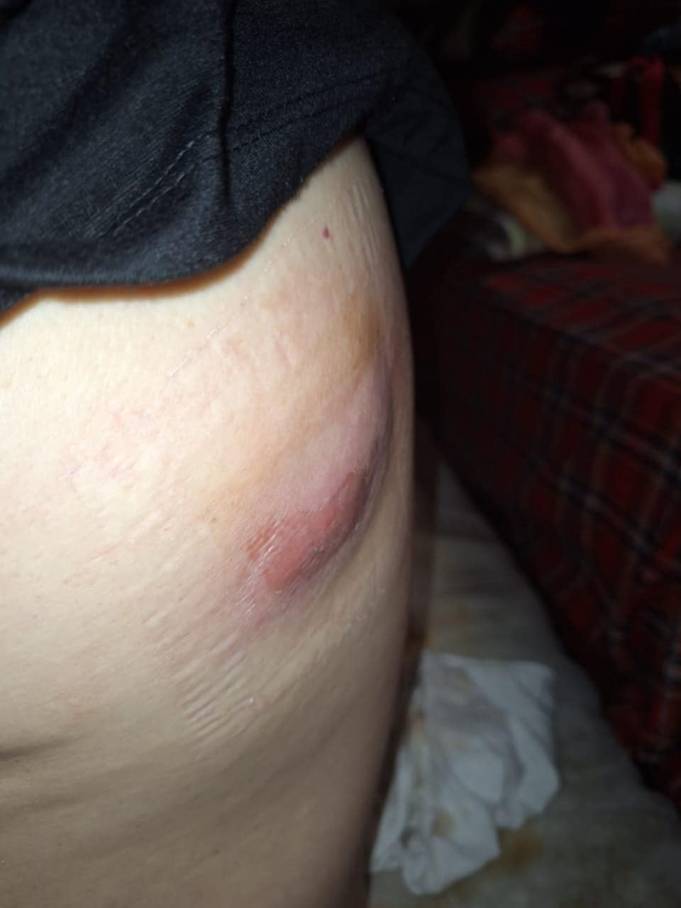 Sick woman needs help, my trial was at best I could've done campaign photo, 6 of 8
