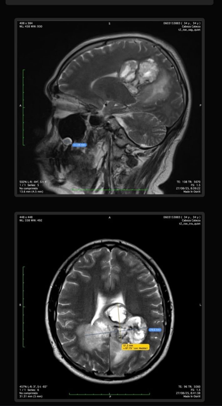 Ayudemos a Pablo a ganar su lucha contra el cáncer cerebral campaign photo, 2 of 6