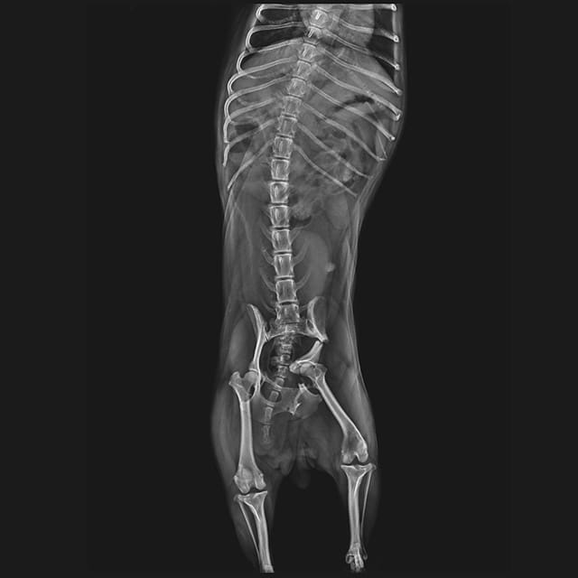 Help Dandara to walk again - Pelvis Fracture Surgery Needed campaign photo, 4 of 8