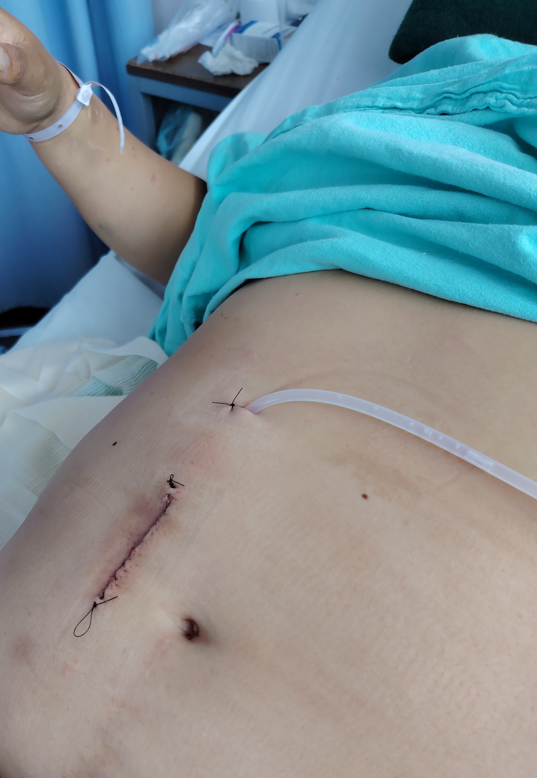 A Second Chance at Life: Help Carmen Get a Kidney Transplant campaign photo, 5 of 8
