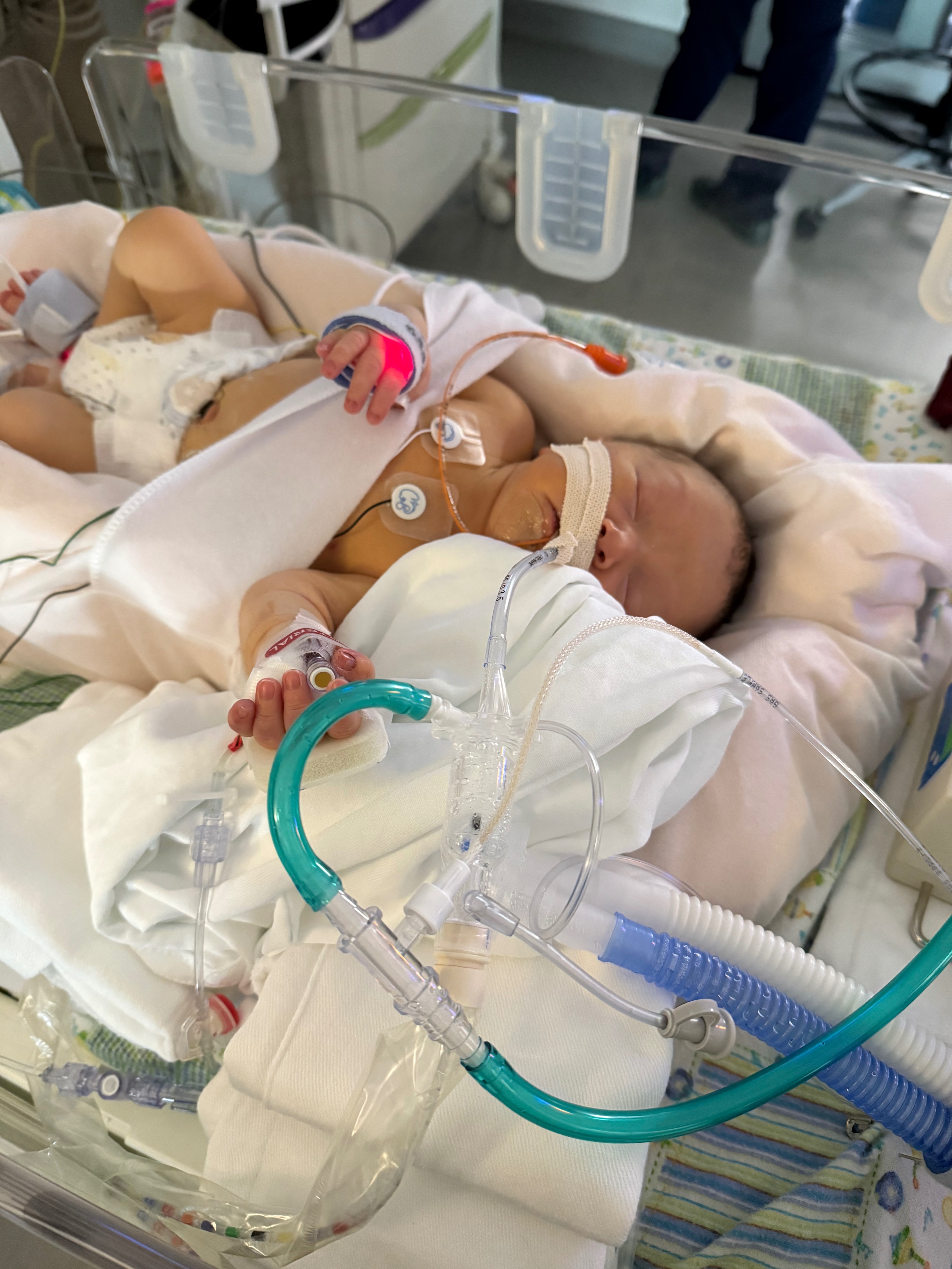 Help Baby River's Journey to Recovery campaign photo, 2 of 4