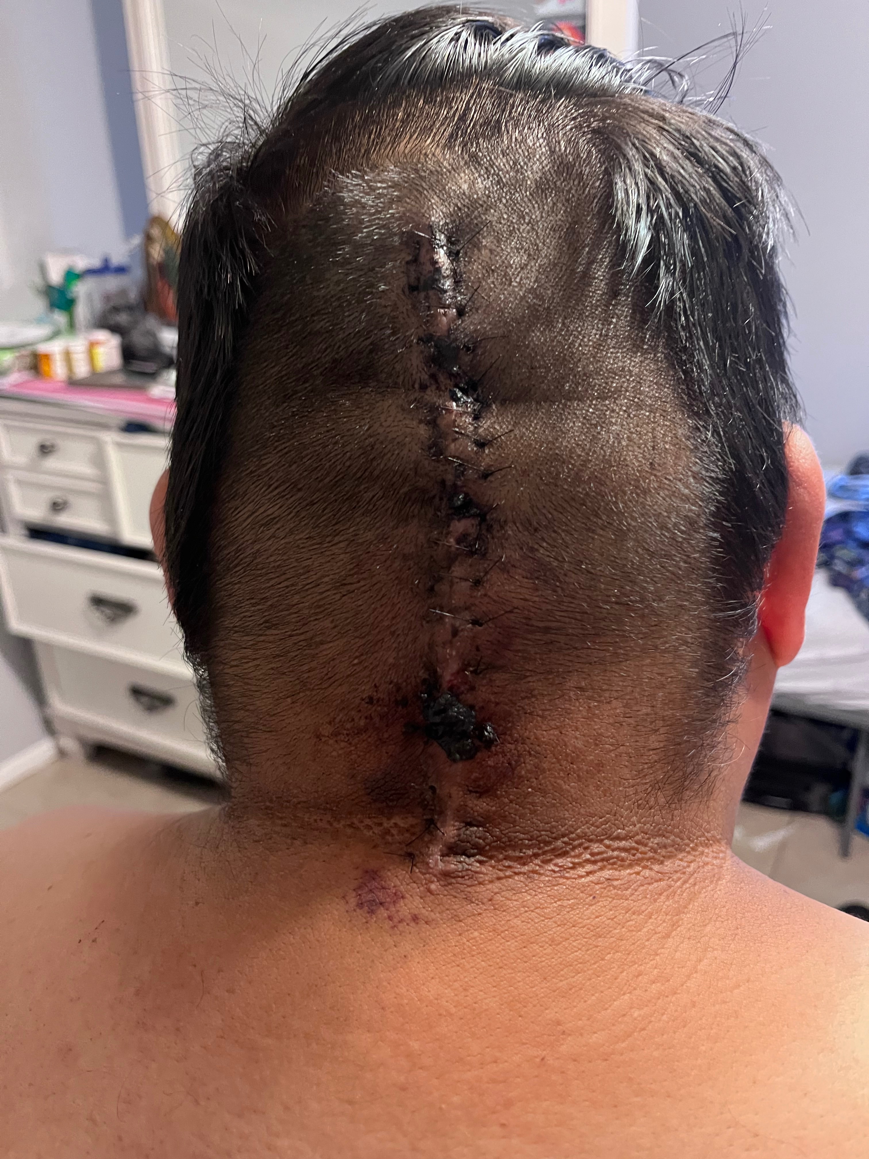 Support Javier's Medical Journey campaign photo, 2 of 6