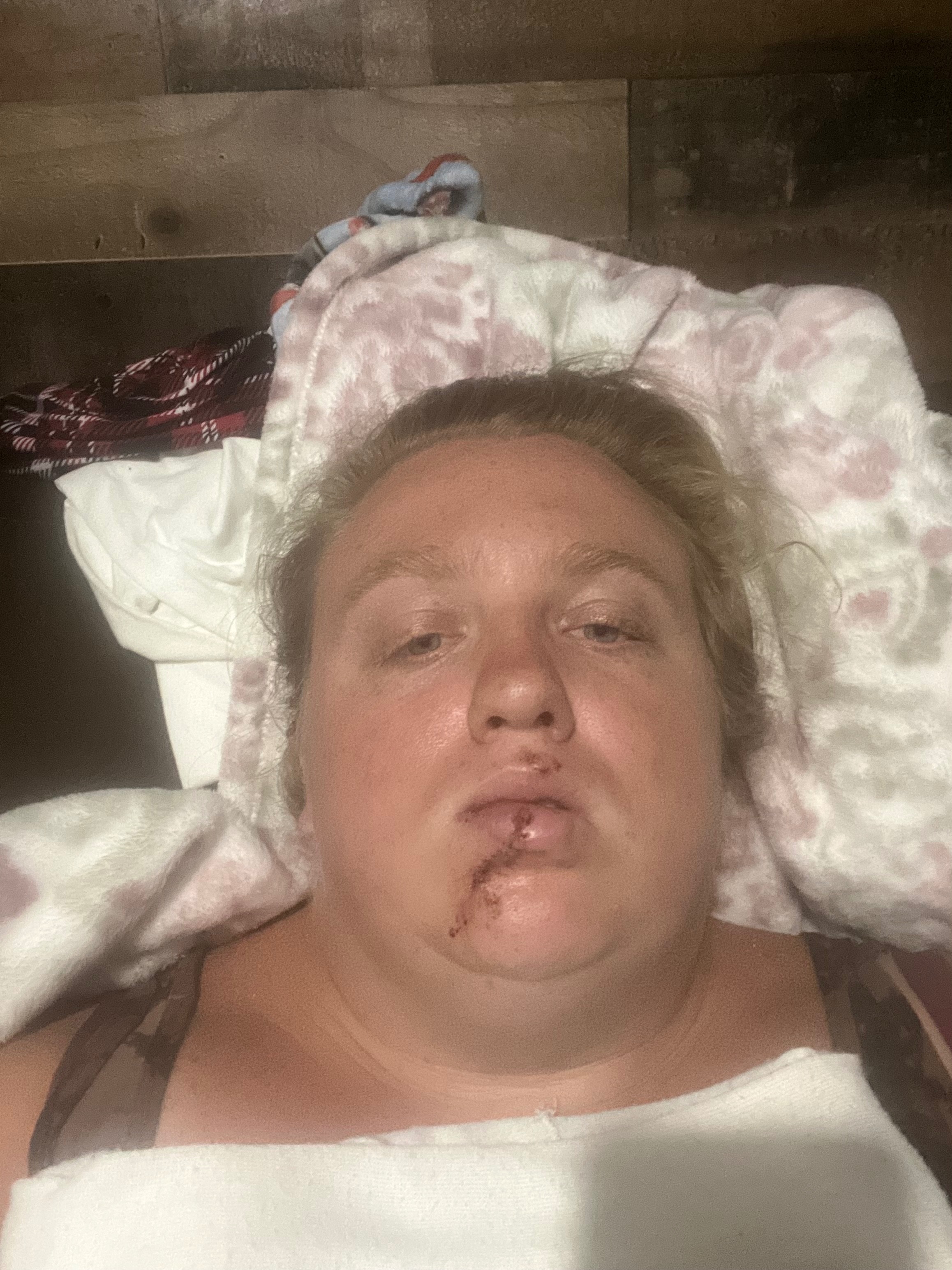 Aid Paige's Recovery from Pit Bull Attack campaign photo, 2 of 5