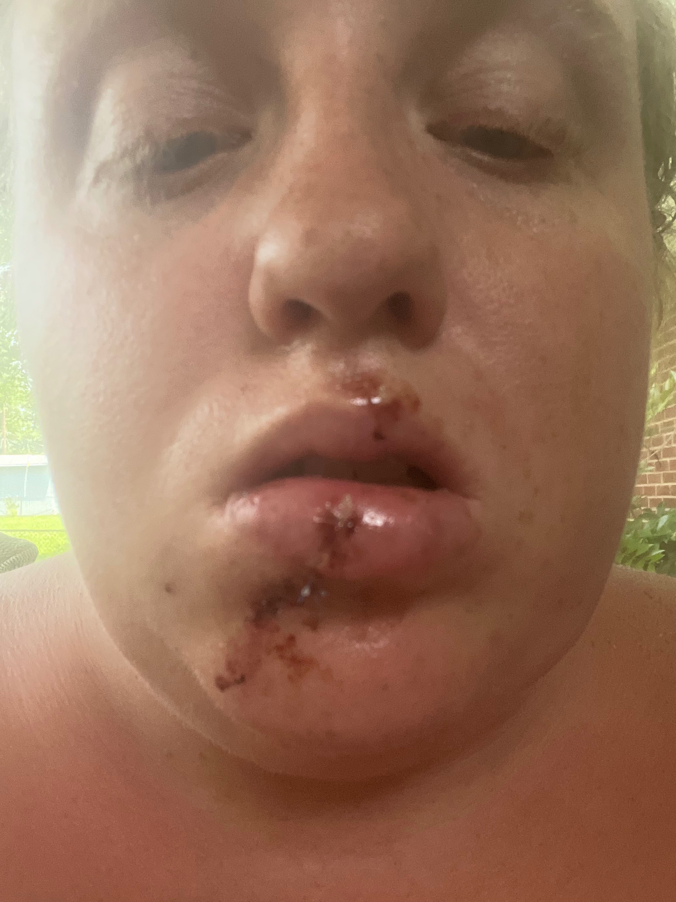 Aid Paige's Recovery from Pit Bull Attack campaign photo, 4 of 5