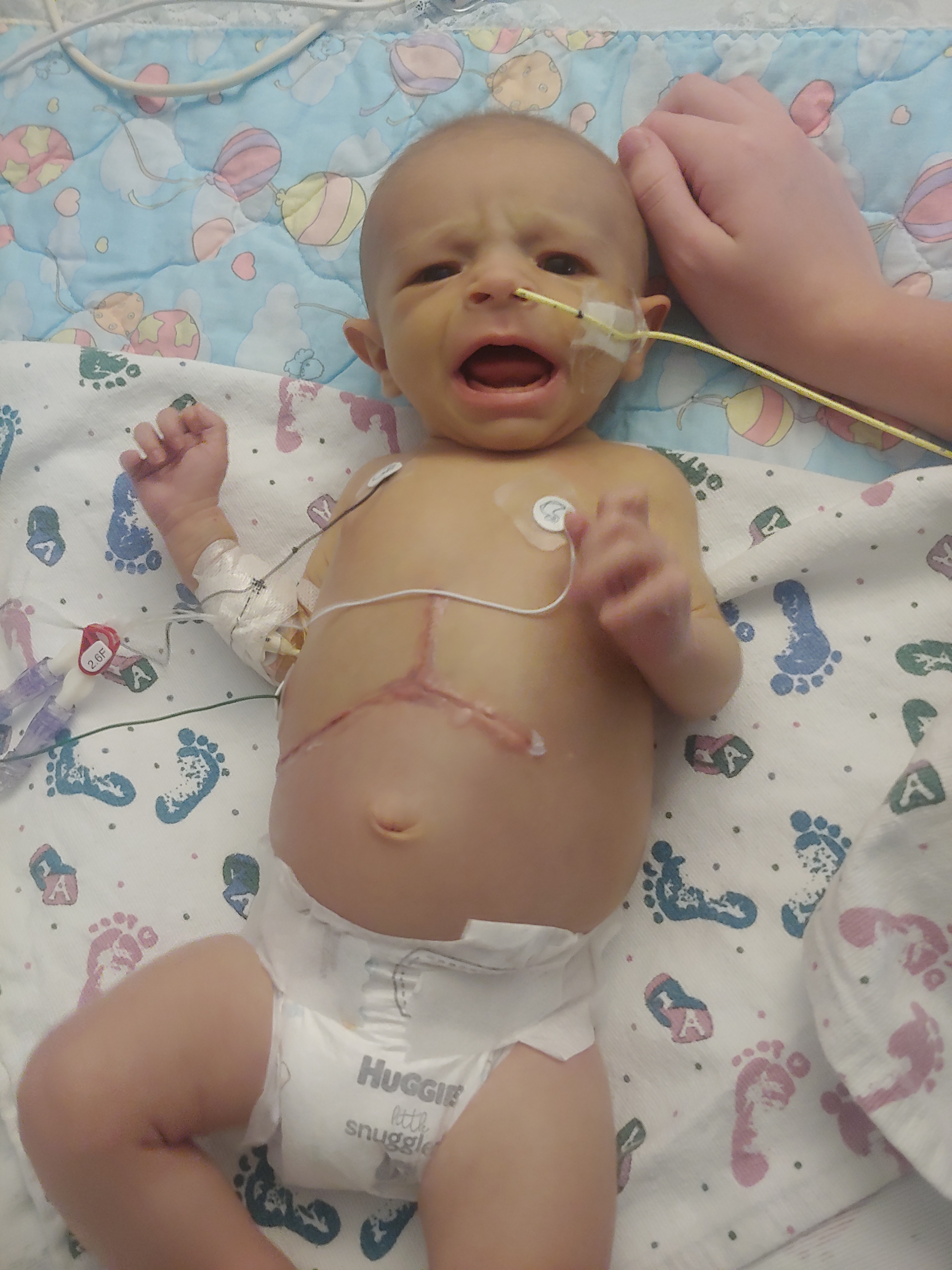 Help Baby Willow's Fight Against Liver Disease campaign photo, 2 of 7