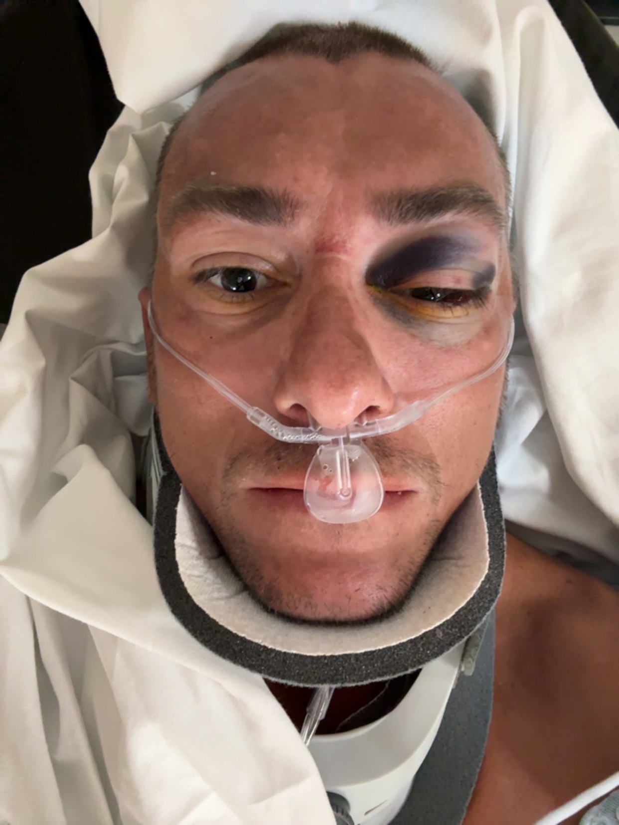 Help support Max’s recovery after the accident. campaign photo, 5 of 6