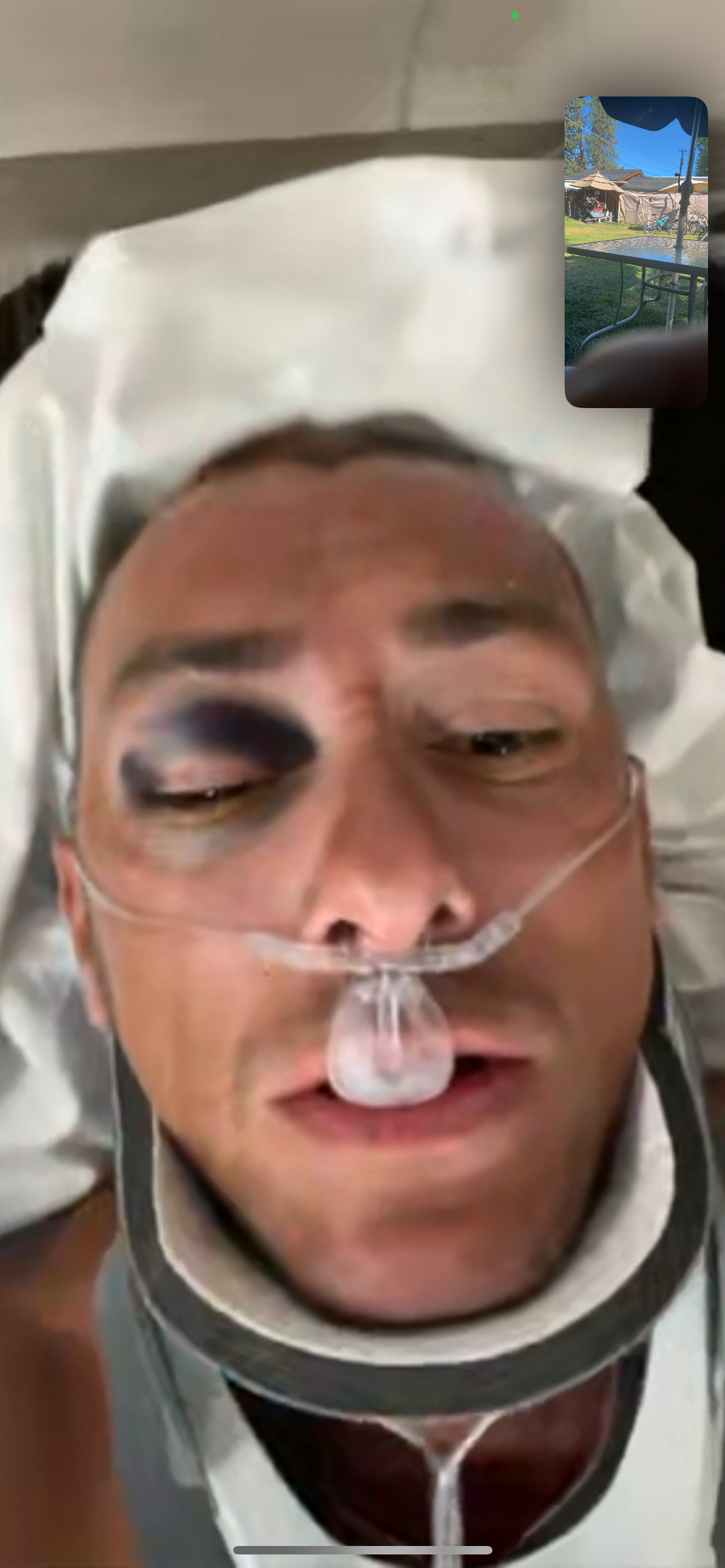 Help support Max’s recovery after the accident. campaign photo, 2 of 6