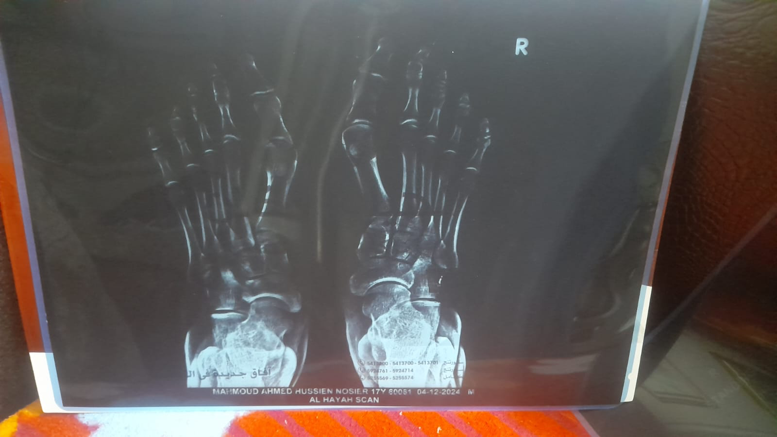 Help Mahmood Walk Again: Urgent Surgery Needed campaign photo, 5 of 6