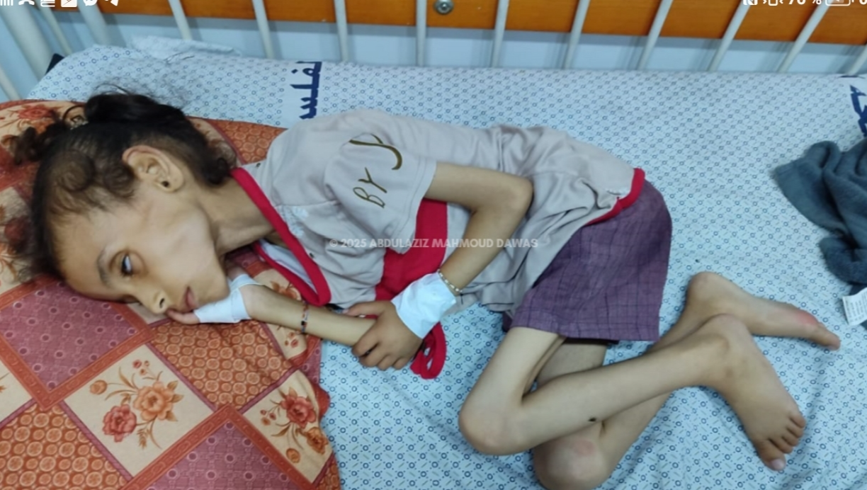 Donate to save 9 years old Maryam from starvation in Gaza pinned link photo