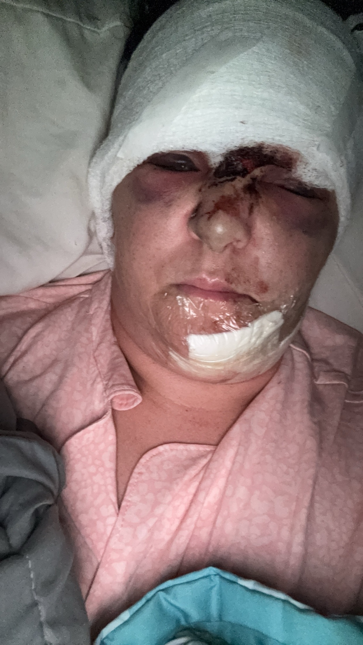 My recovery campaign photo, 2 of 5