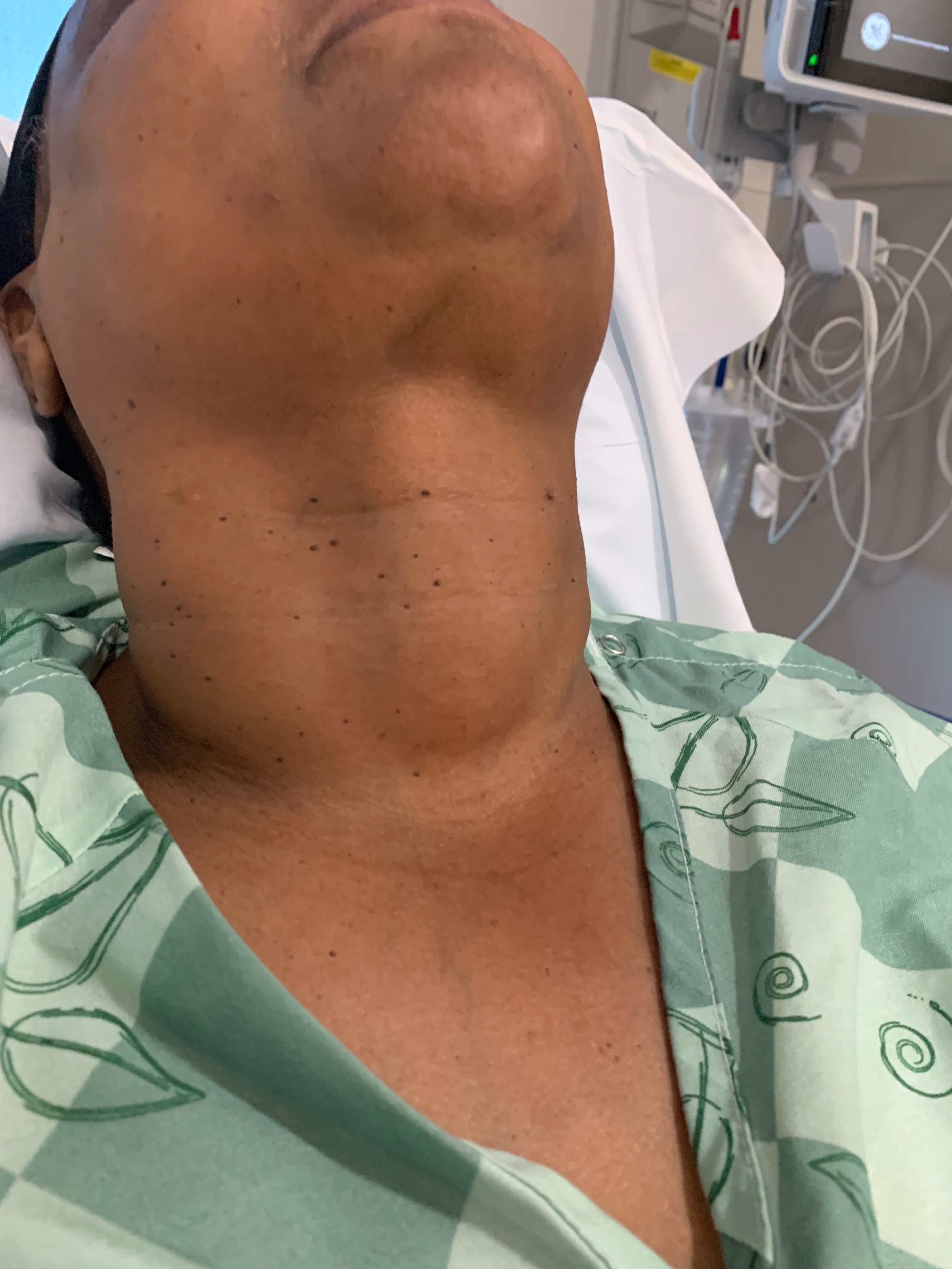 Support Recovery After Thyroid Surgery campaign photo, 2 of 8