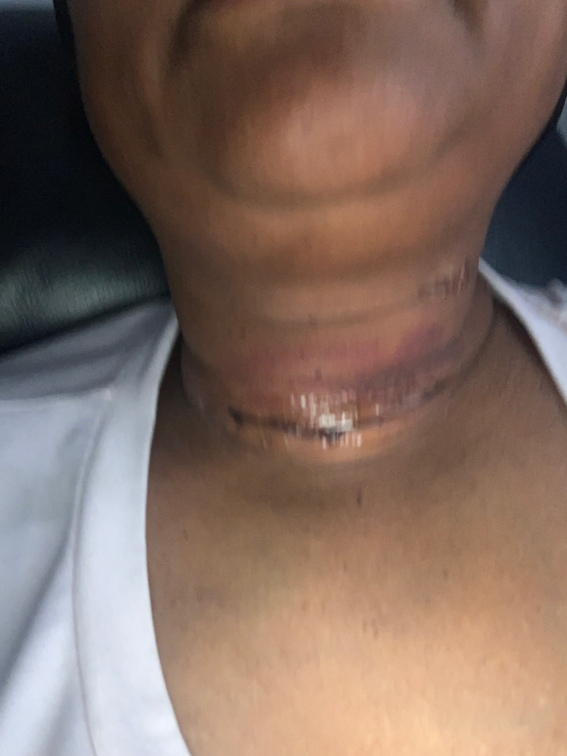 Support Recovery After Thyroid Surgery campaign photo, 4 of 8