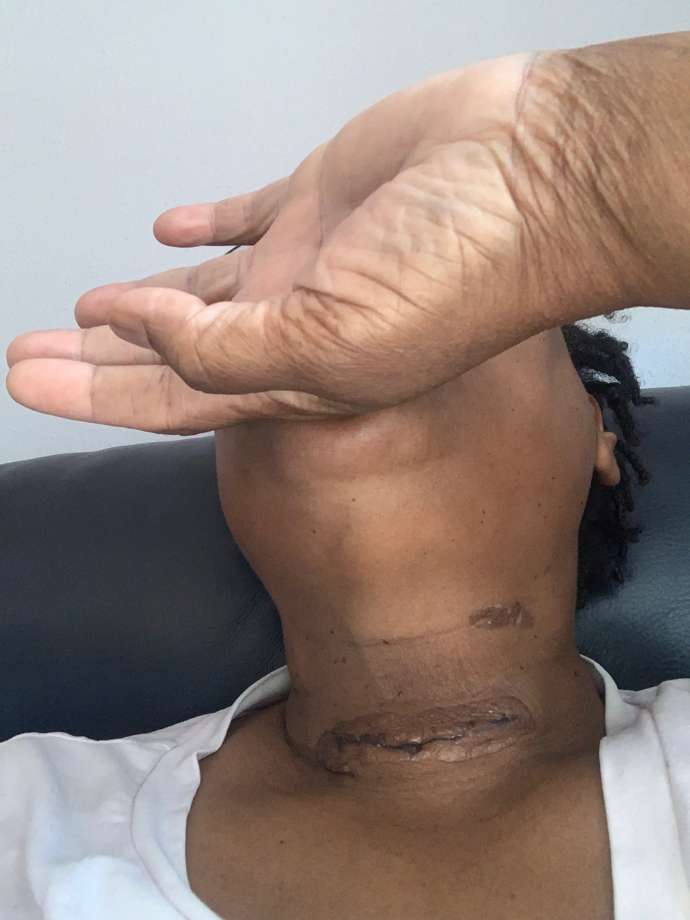 Support Recovery After Thyroid Surgery campaign photo, 6 of 8