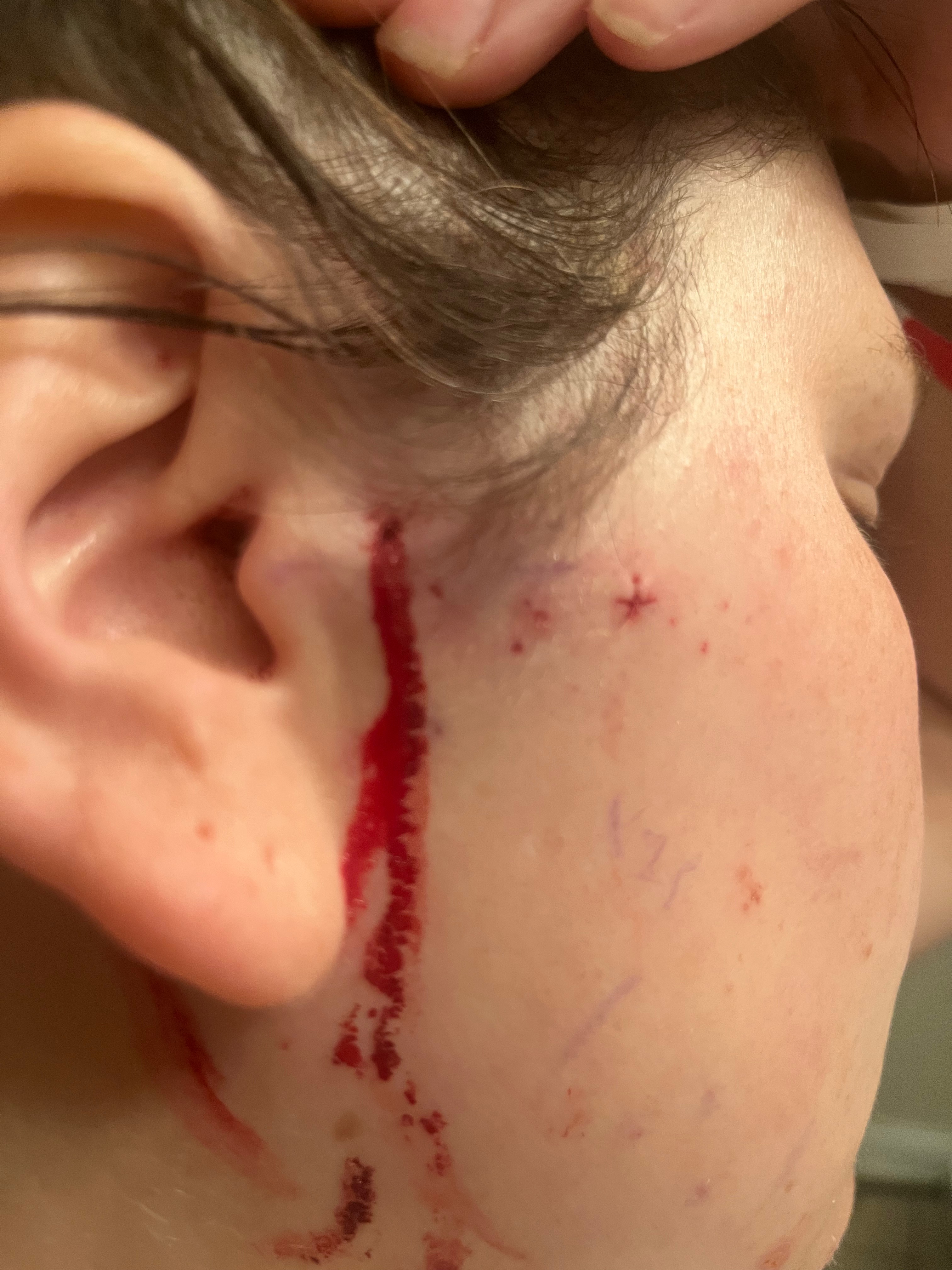 Help relieve our families stress from ongoing surgeries campaign photo, 4 of 6