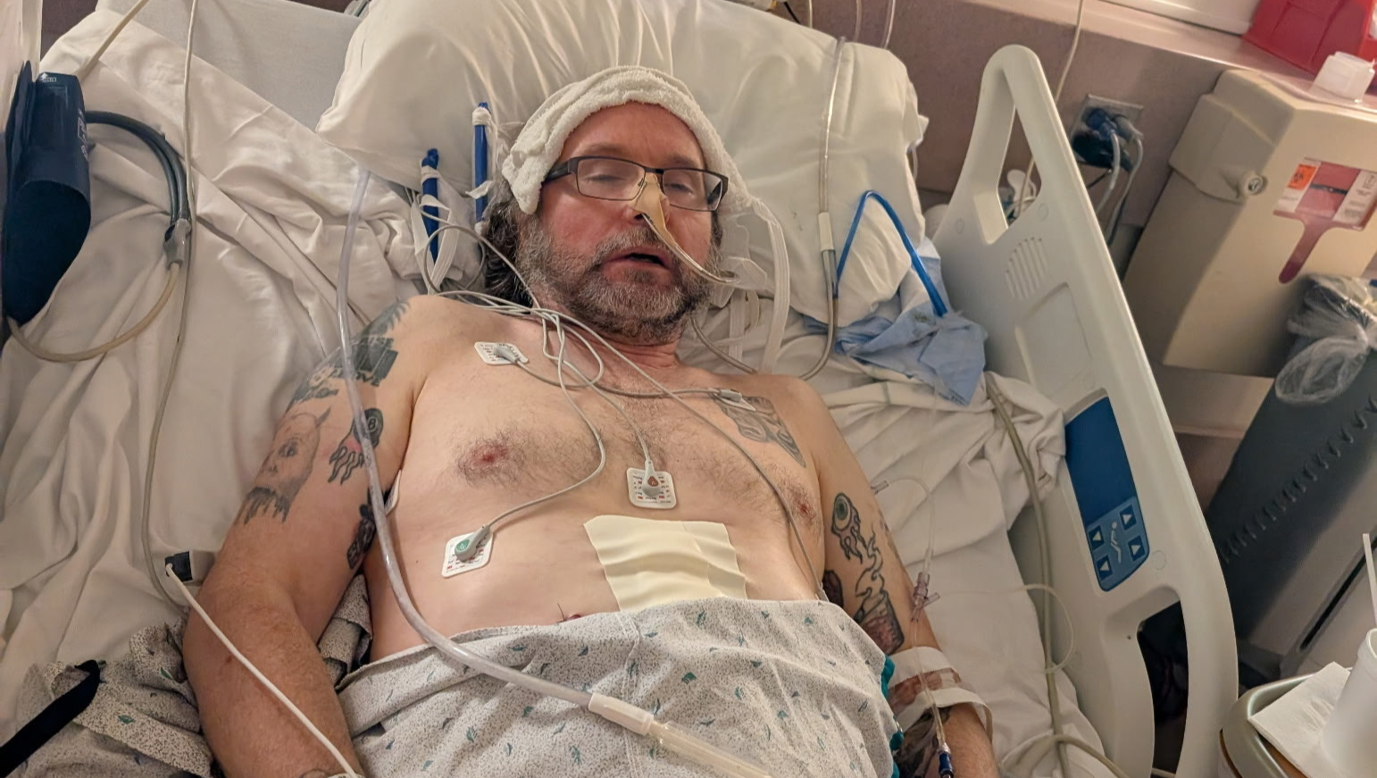 HELP NEIL BURKE WITH HIS EMERGENCY SURGERY RECOVERY photo