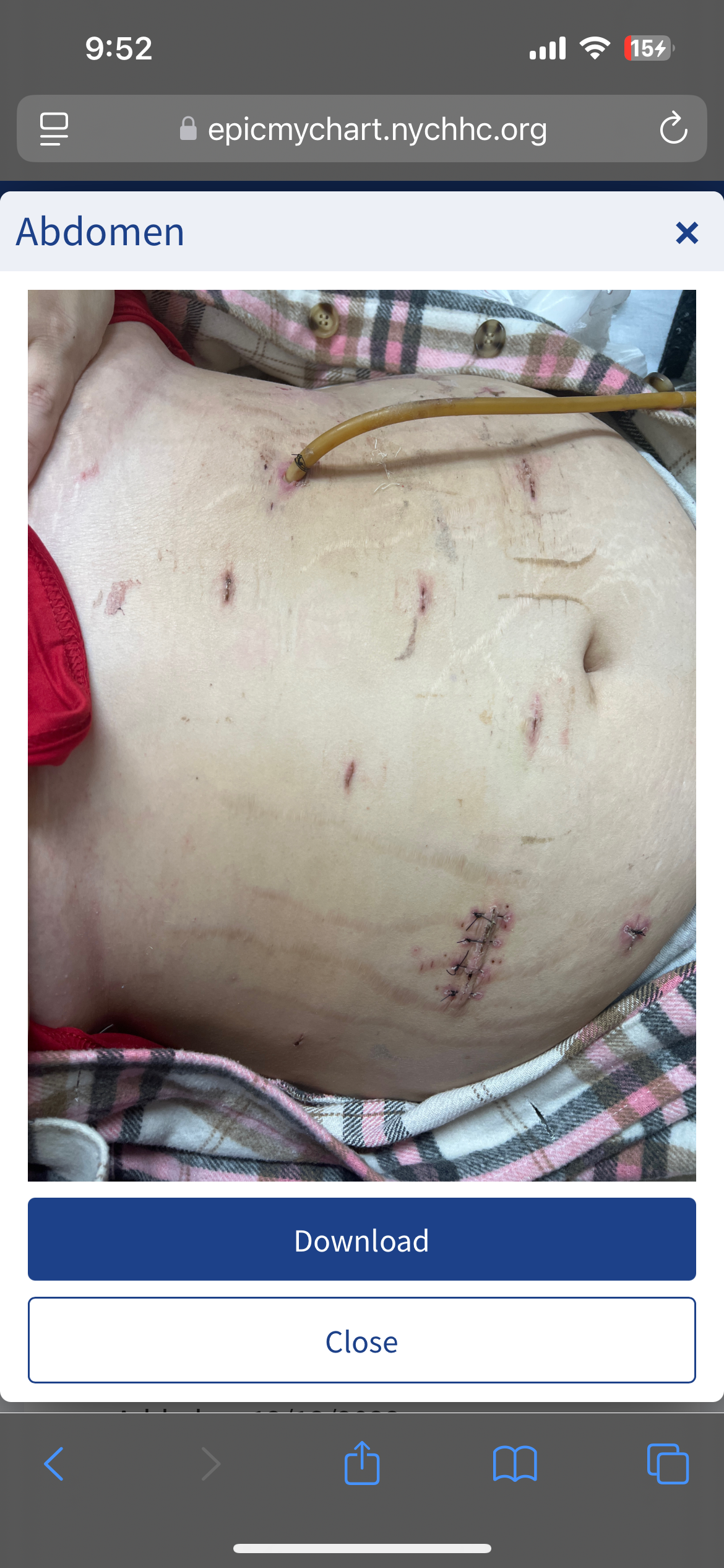 Support Chasidy's Journey to Recovery and Stability campaign photo, 2 of 8