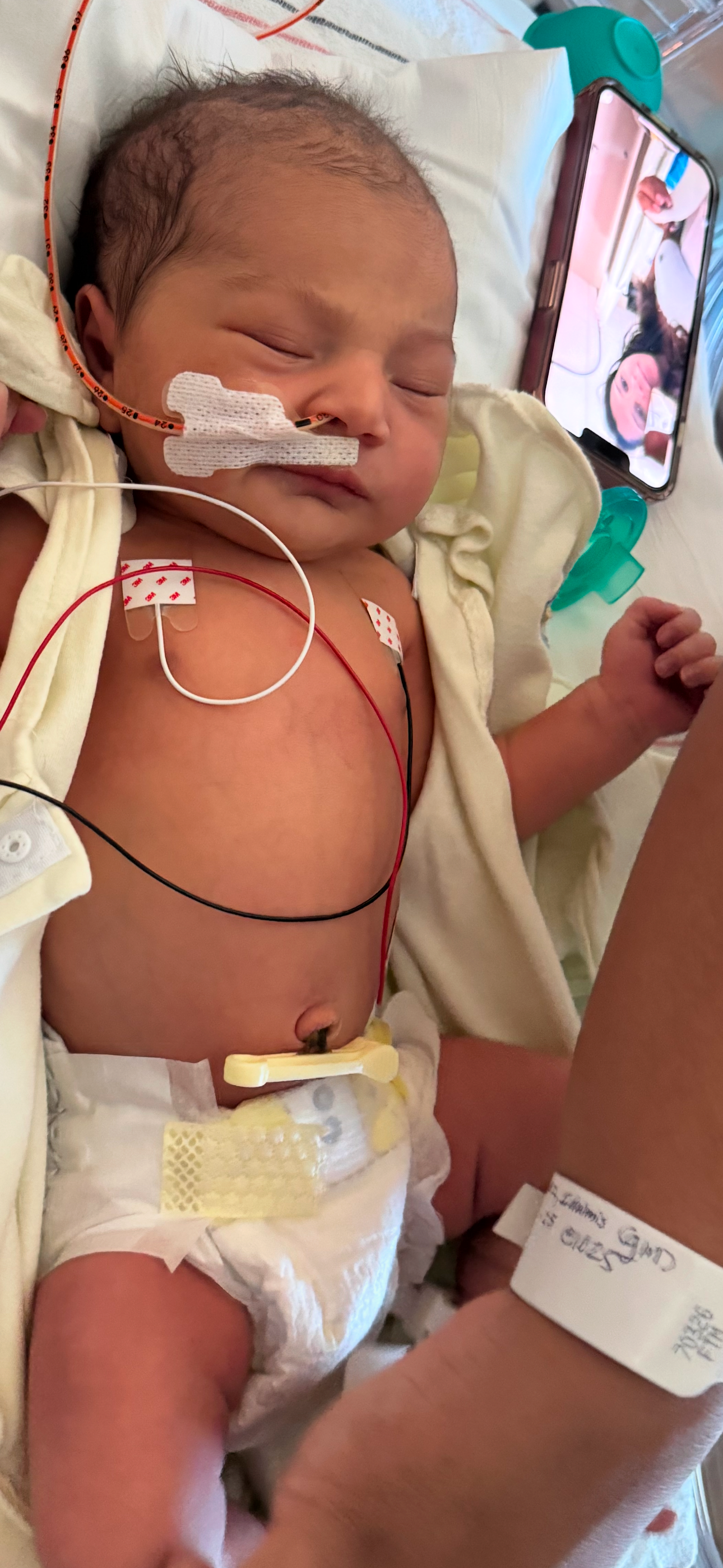 Oaklynn's Long NICU Stay and Care campaign photo, 2 of 4