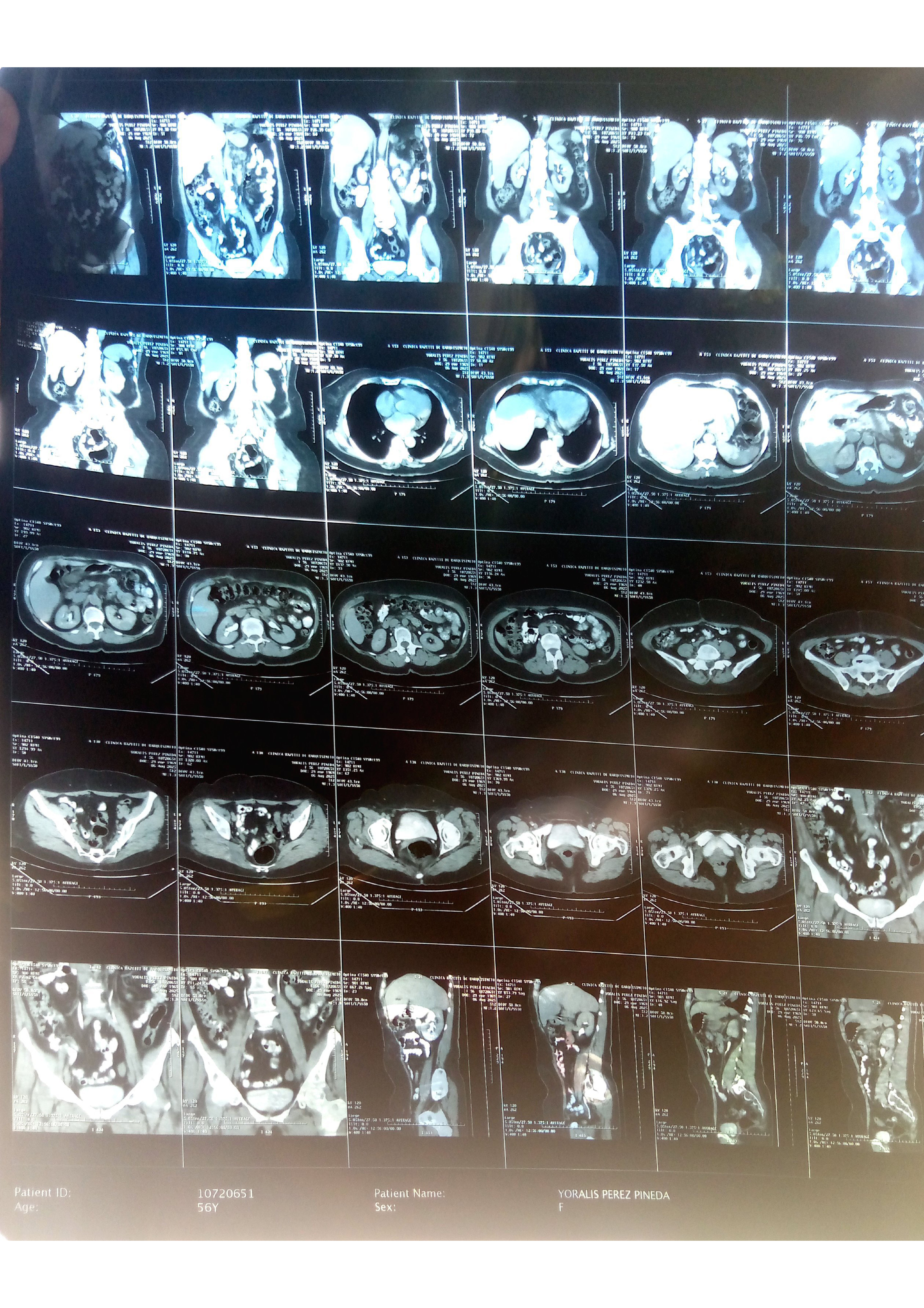 Ayuda a Yoralis Pérez a Vencer un tumor en el Páncreas campaign photo, 5 of 8
