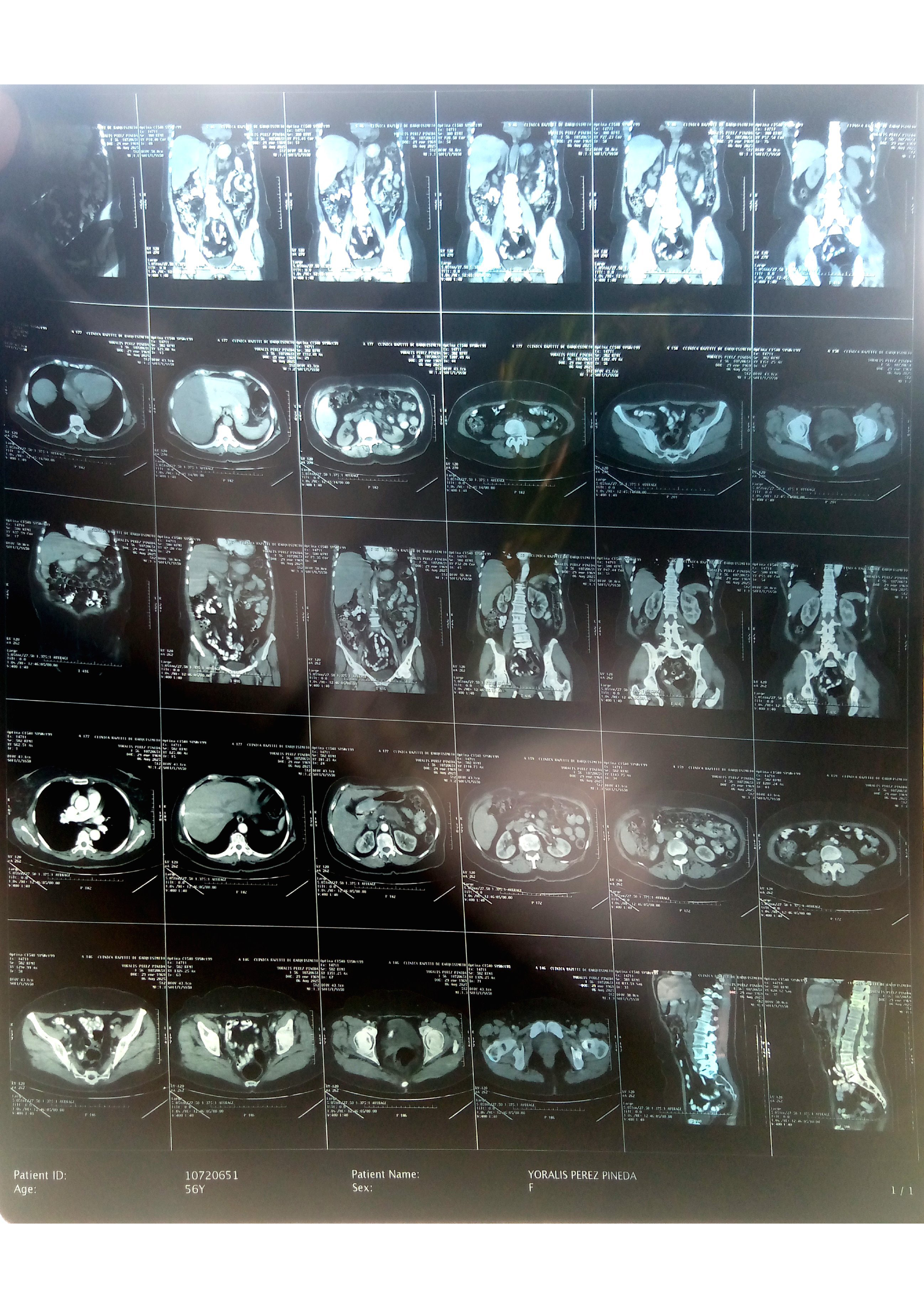 Ayuda a Yoralis Pérez a Vencer un tumor en el Páncreas campaign photo, 6 of 8
