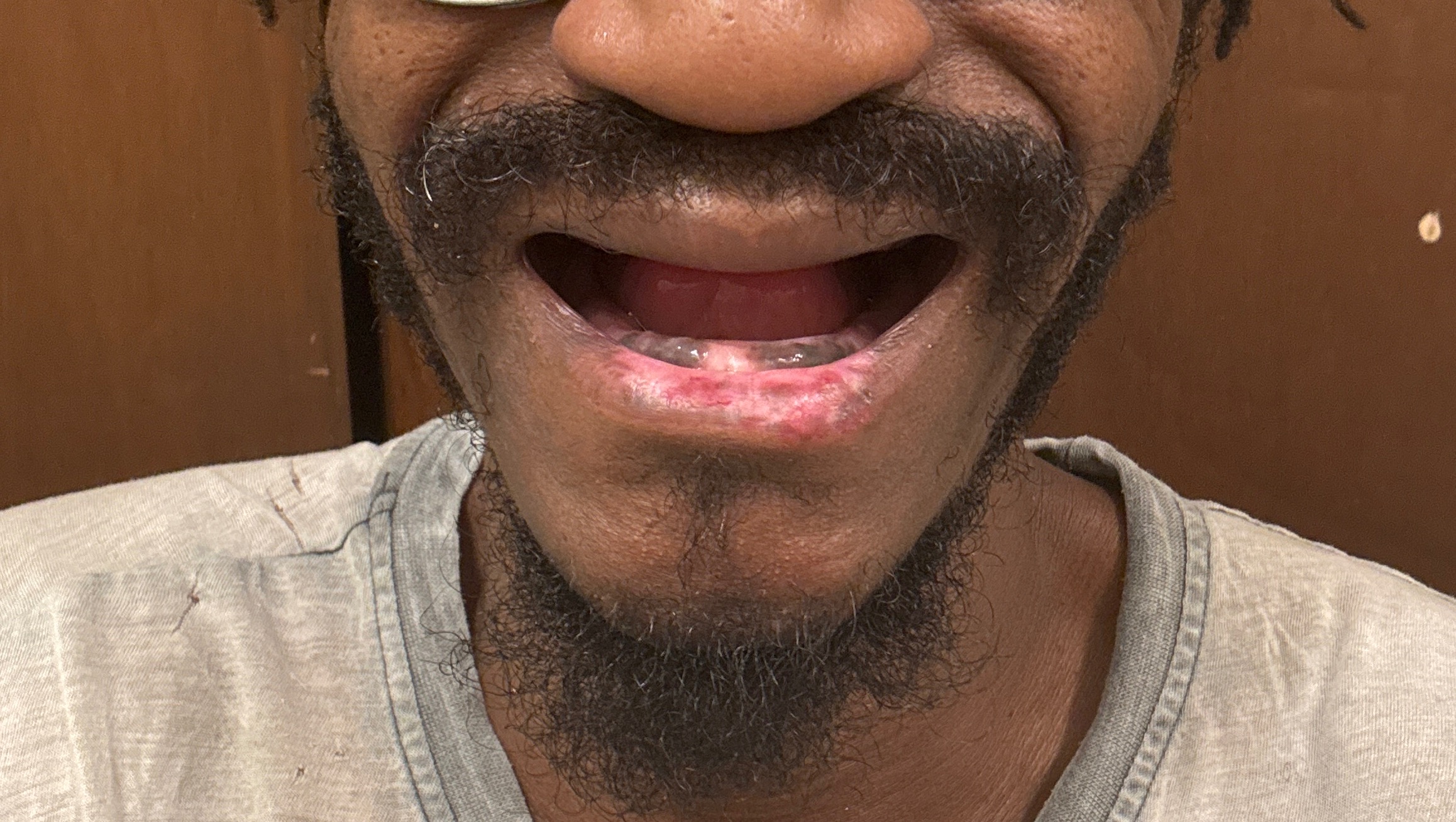 Restore smile photo