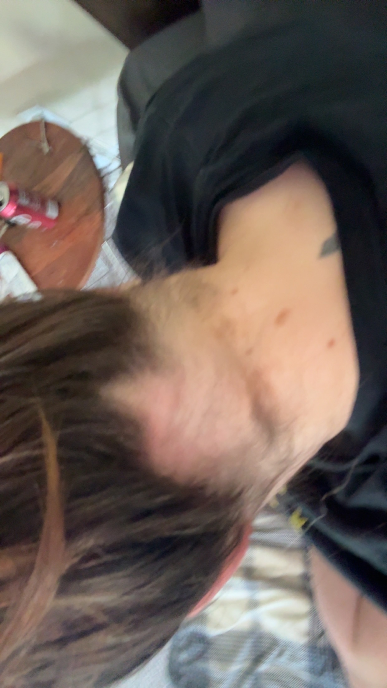 Join Holly in Her Fight Against Hair Loss campaign photo, 6 of 7