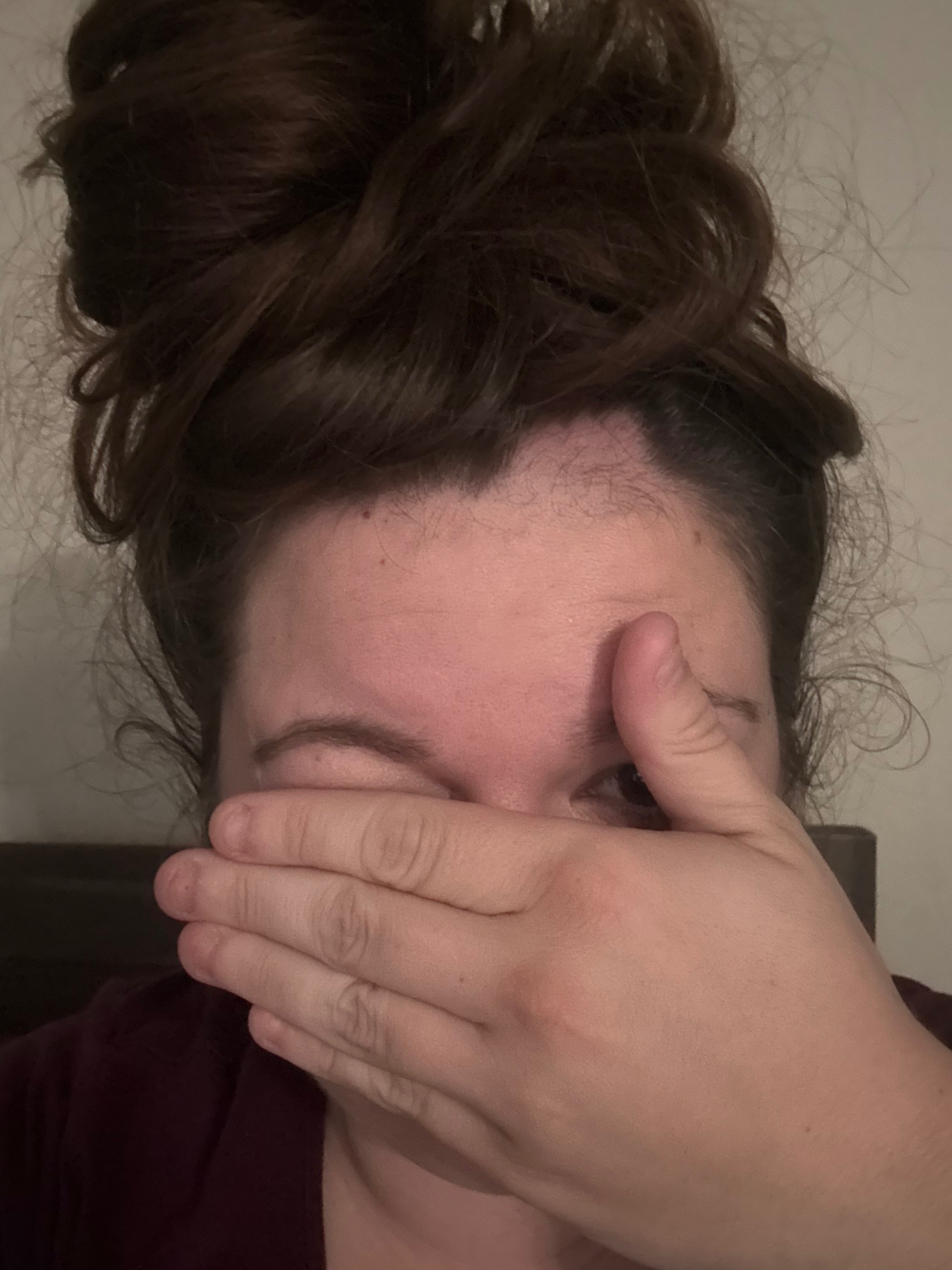 Join Holly in Her Fight Against Hair Loss campaign photo, 2 of 7