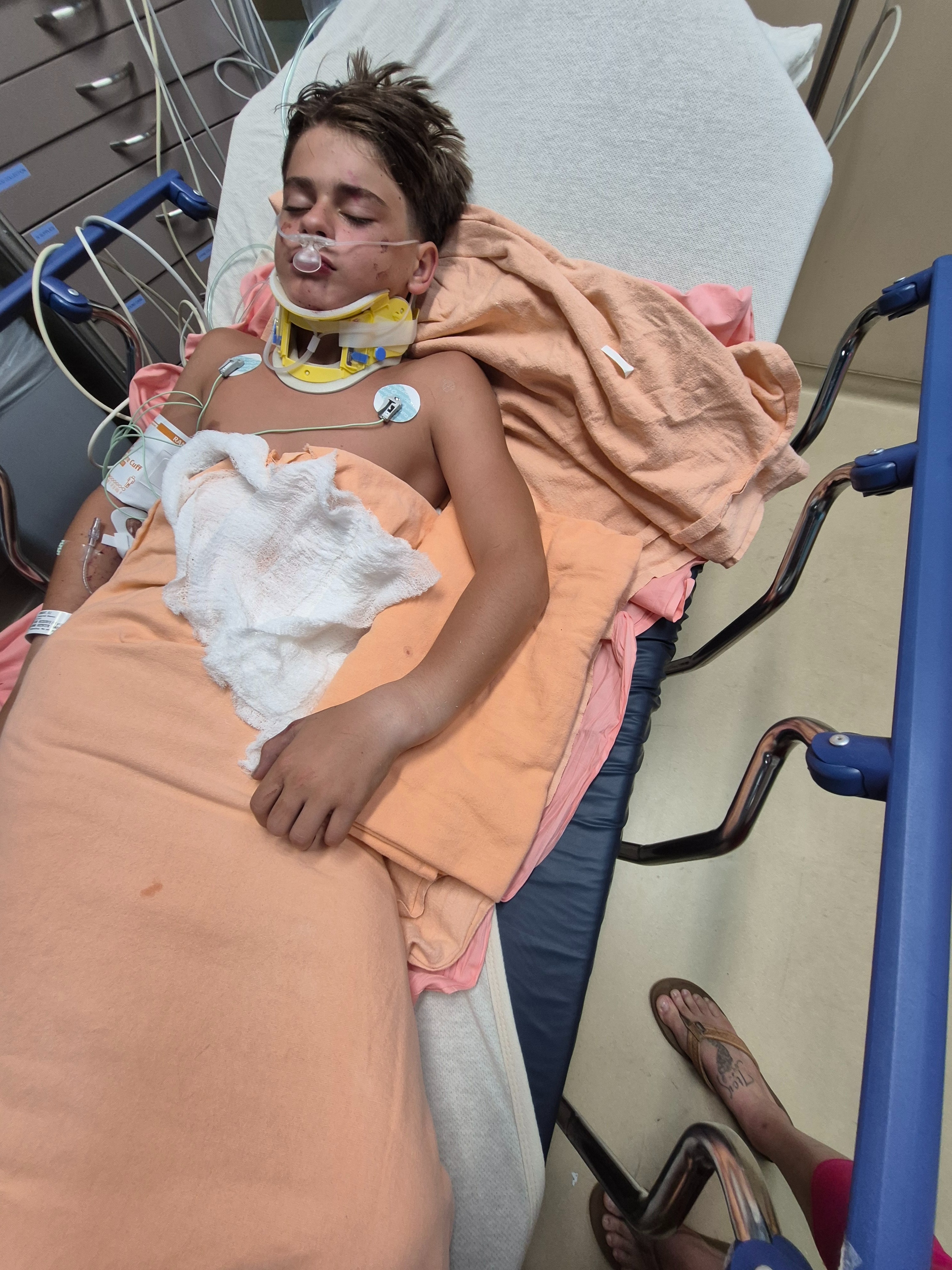 Help Eli Recover from a Severe Accident campaign photo, 7 of 8