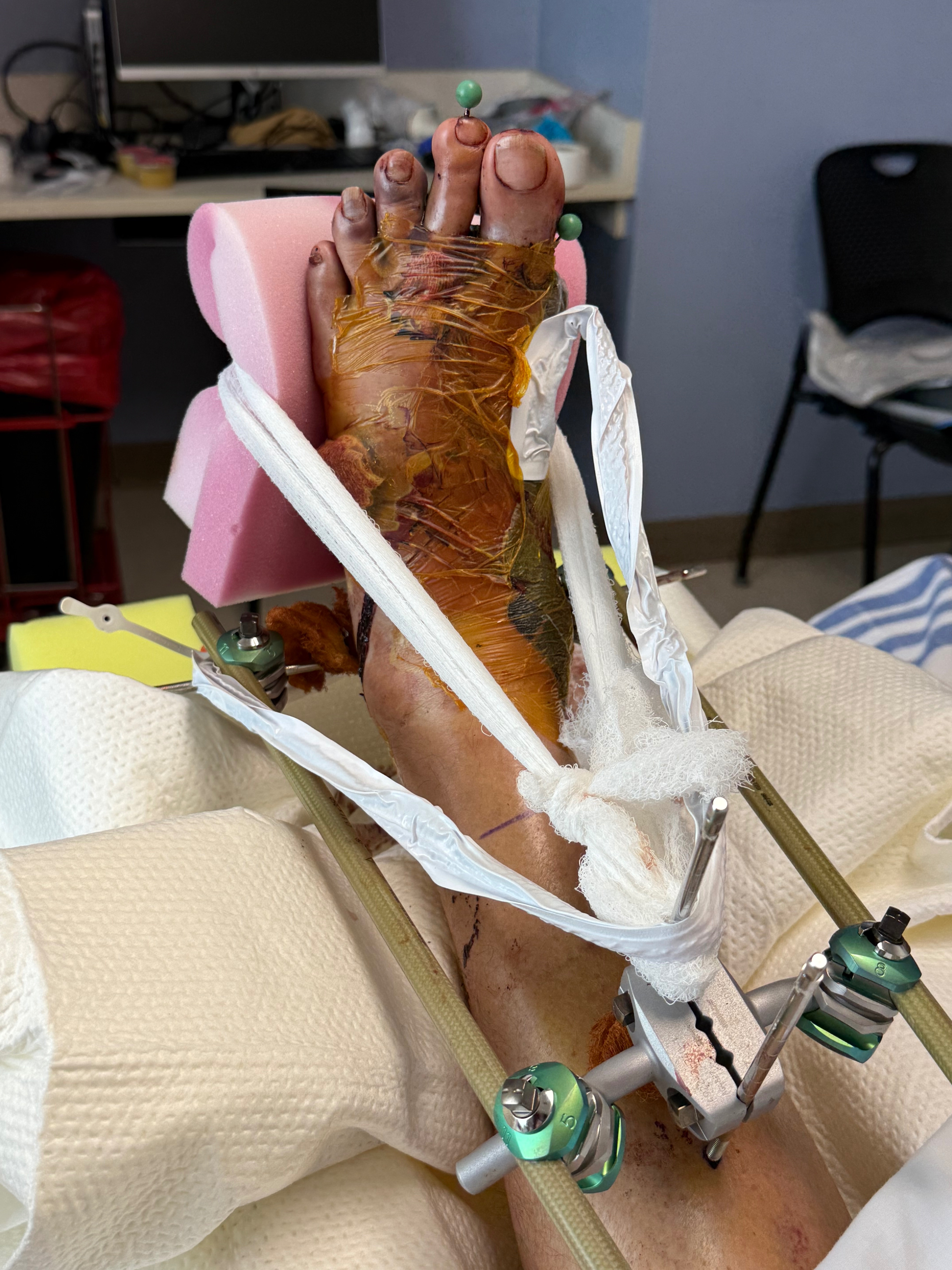 Aid Buggy's Long Road to Recovery campaign photo, 2 of 6