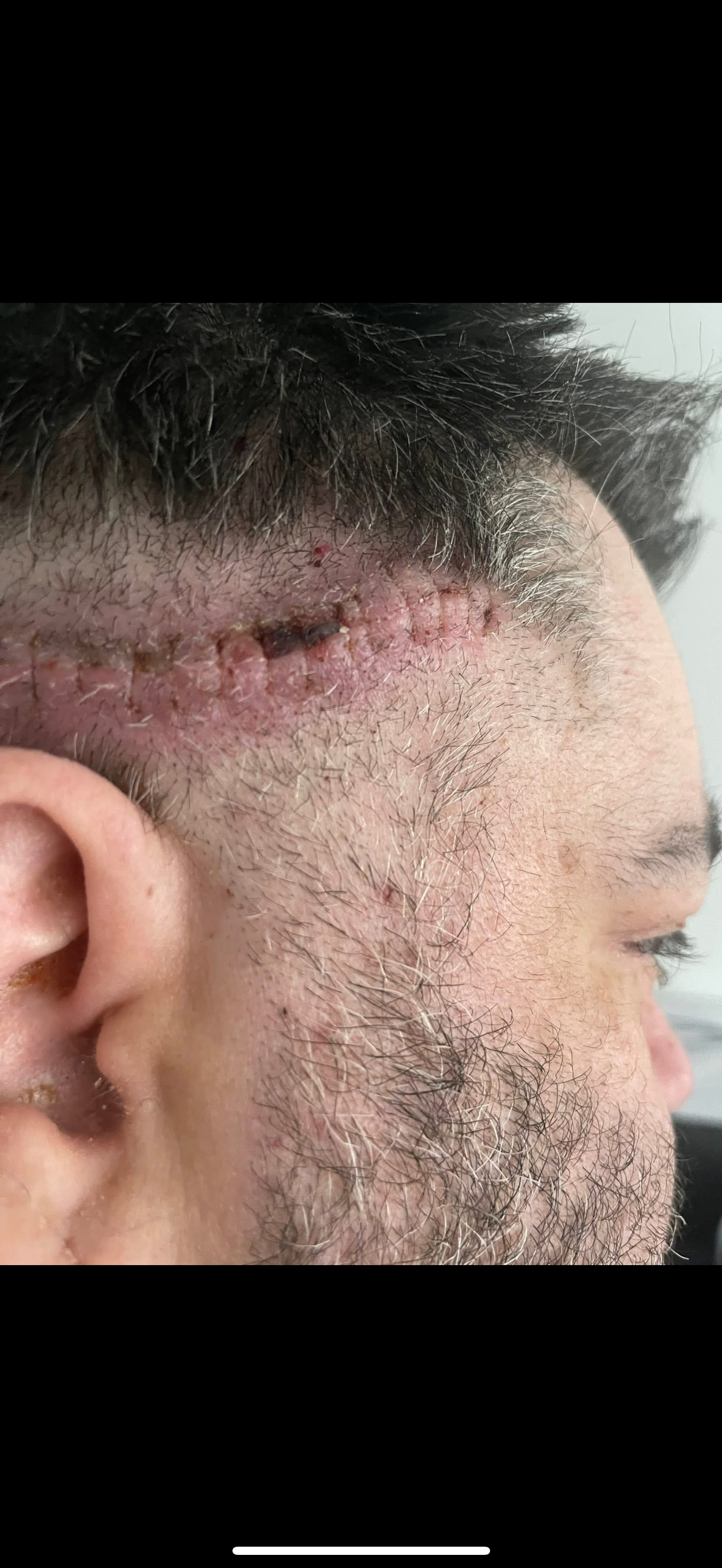 Support Mike's Recovery After Brain Surgery campaign photo, 4 of 5
