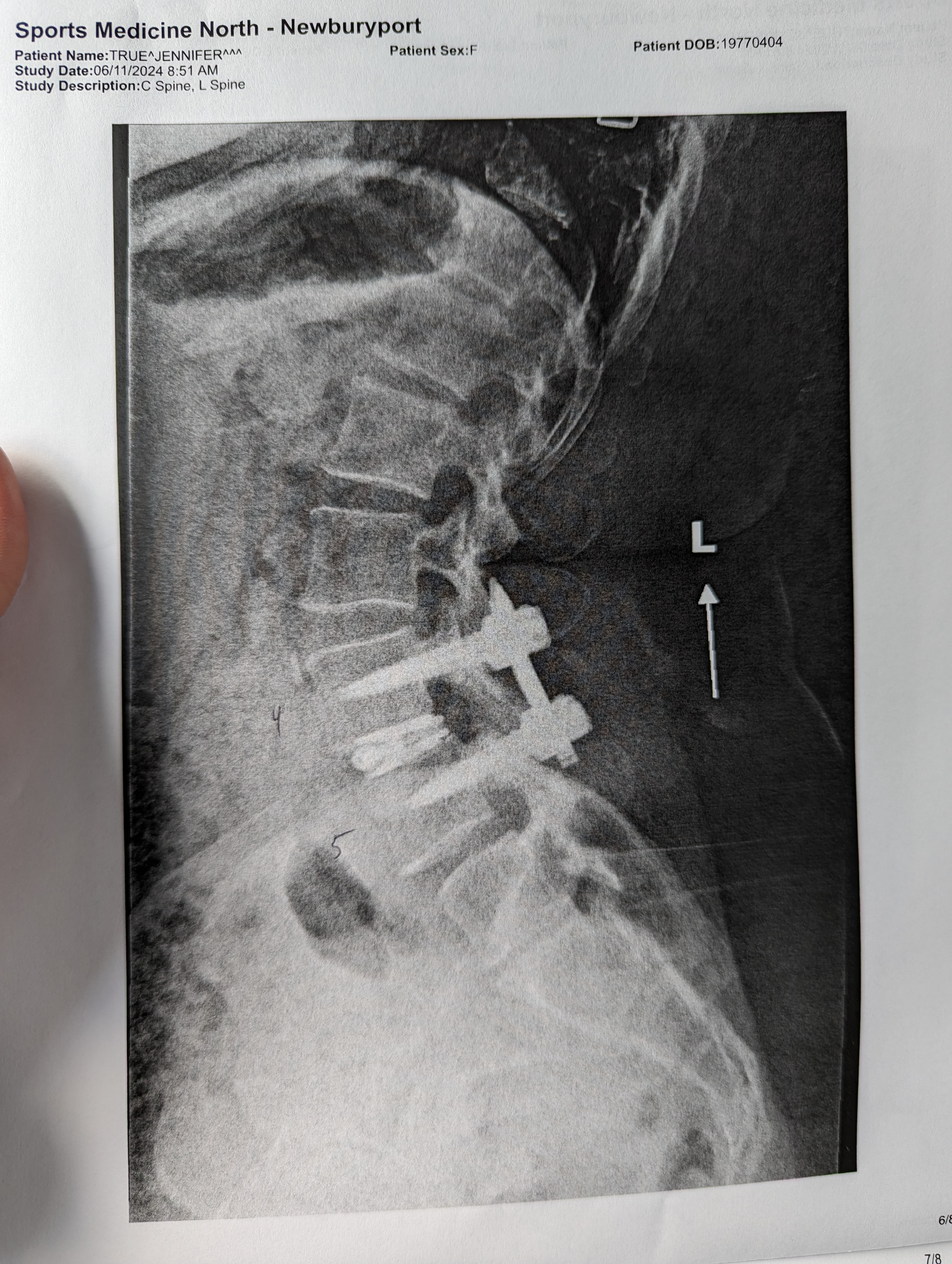 Spinal injury in need of Freedom campaign photo, 5 of 7