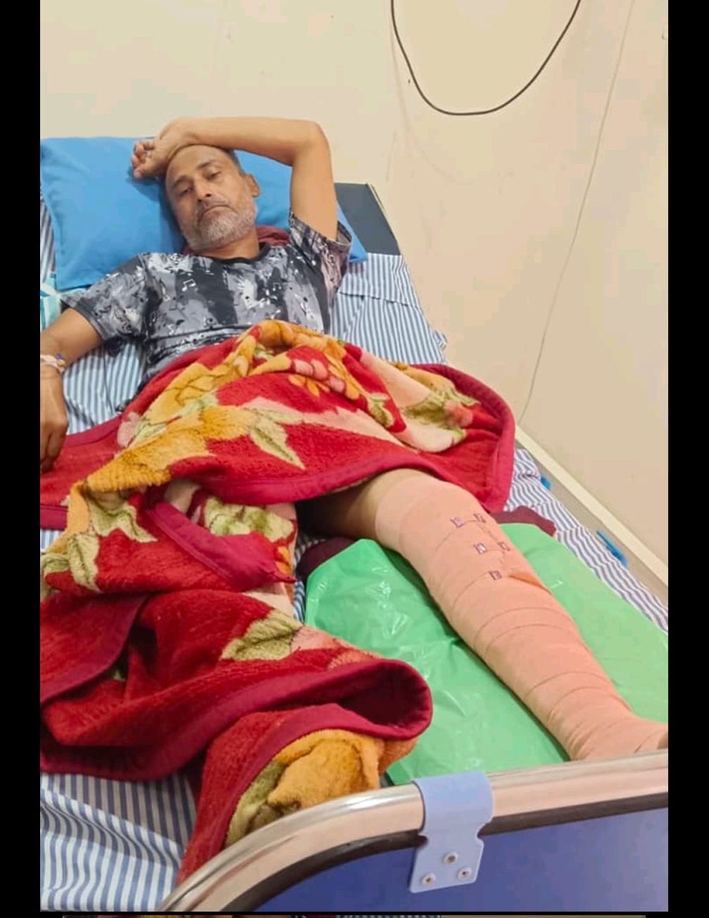 Accident Left Amarjeet, 49, Injured—Poor Family Need help campaign photo, 2 of 3