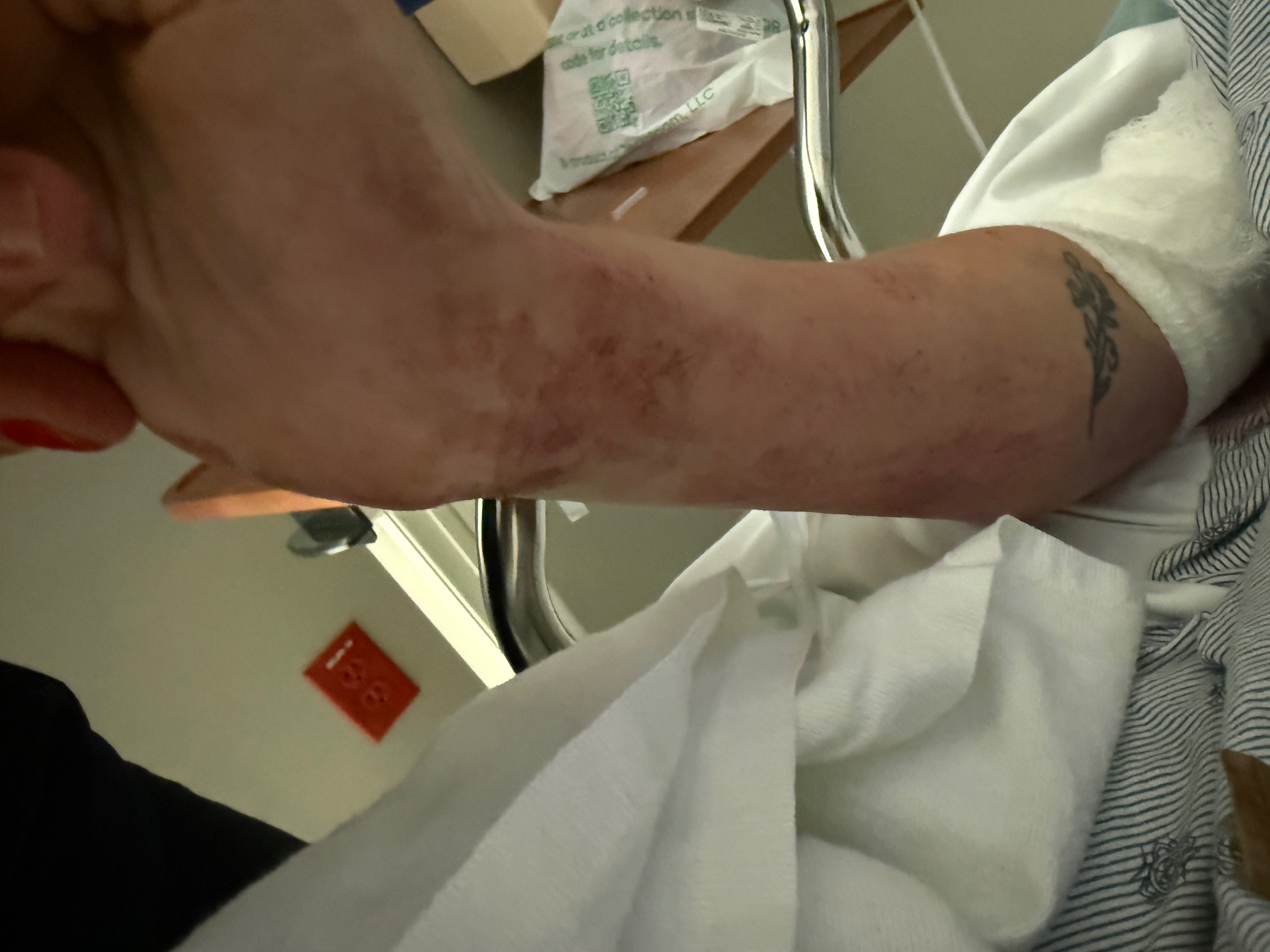 Support Breanna's Journey to Recovery campaign photo, 7 of 8