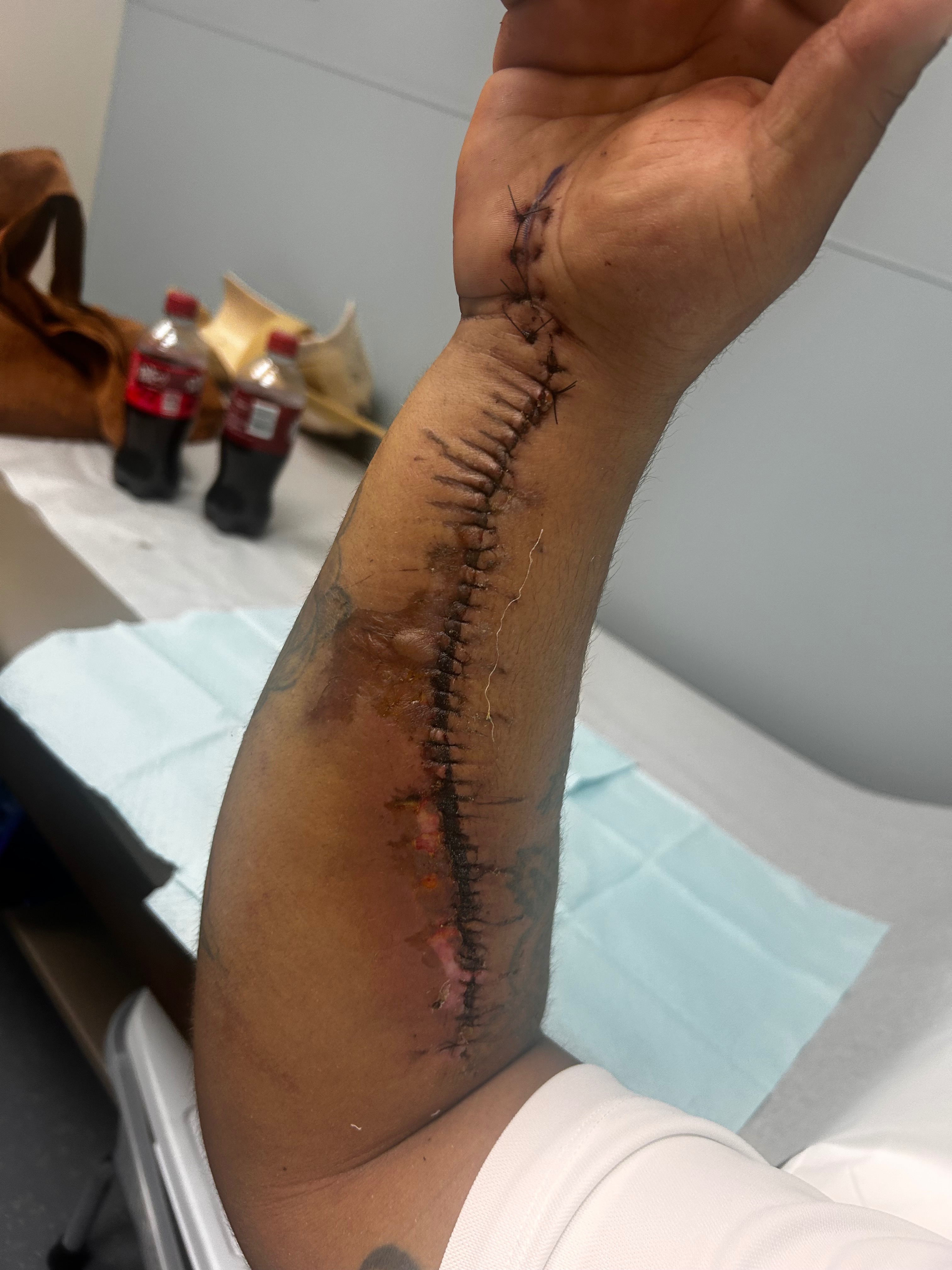Nate's Healing Fund After Accident campaign photo, 5 of 8