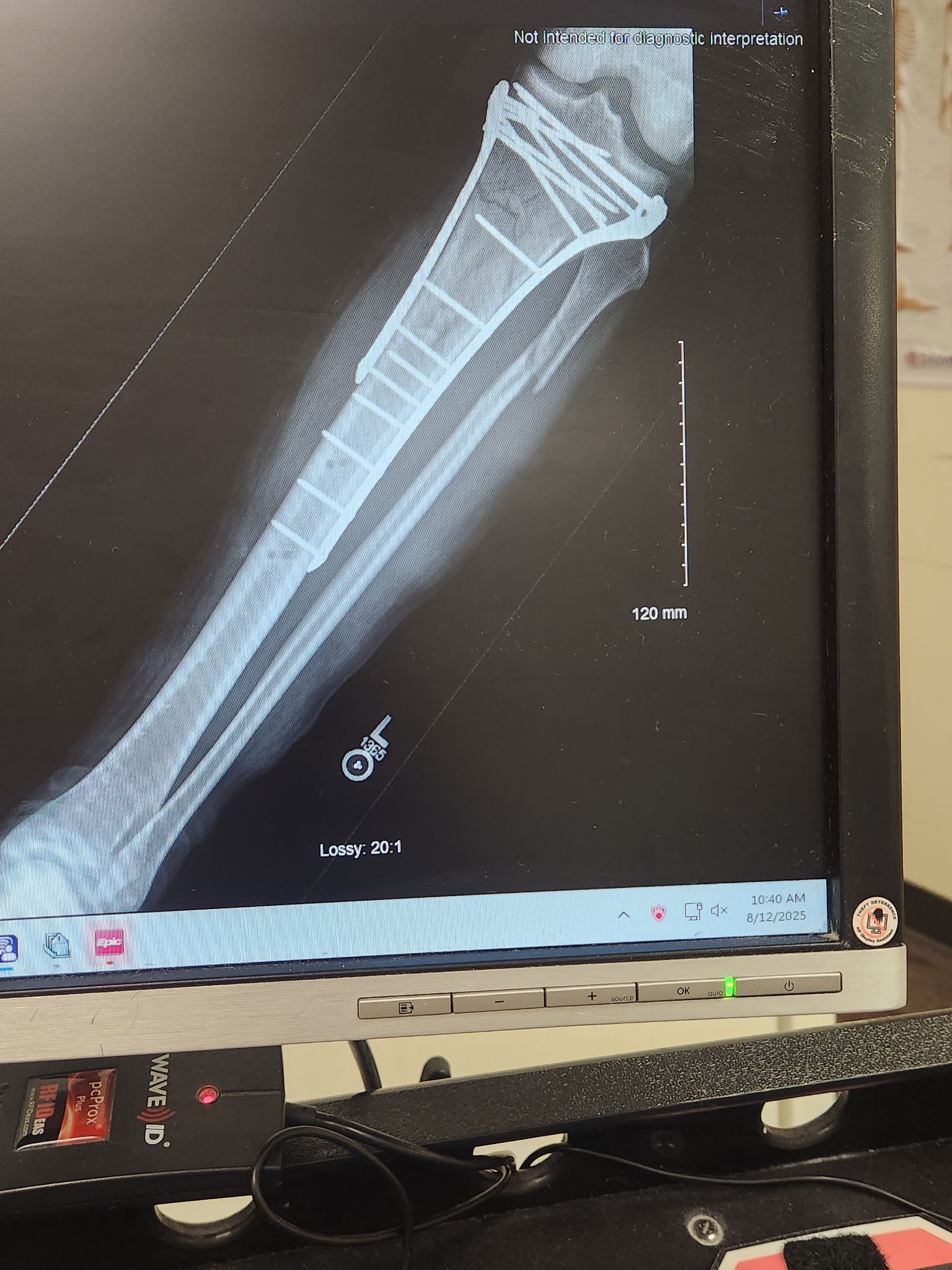 Help Dilly's Family Through His Recovery campaign photo, 5 of 7