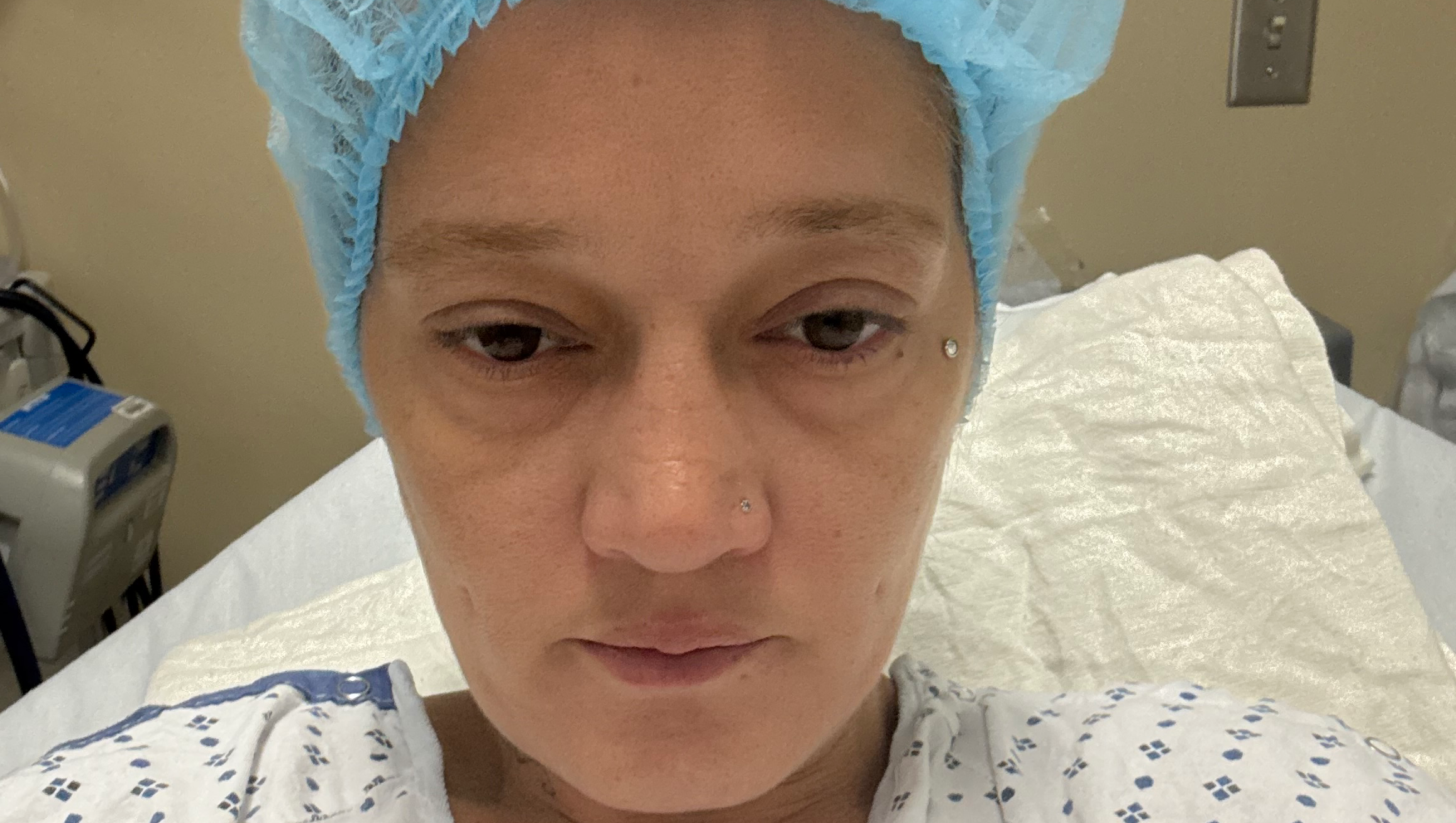 Support Recovery from Diverticulitis Surgery photo