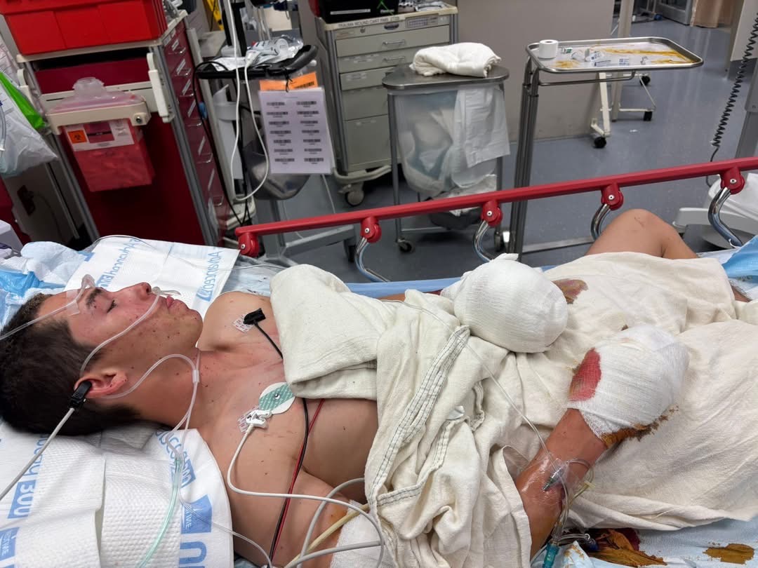 Help Anthony Recover After Devastating Firework Accident campaign photo, 7 of 8