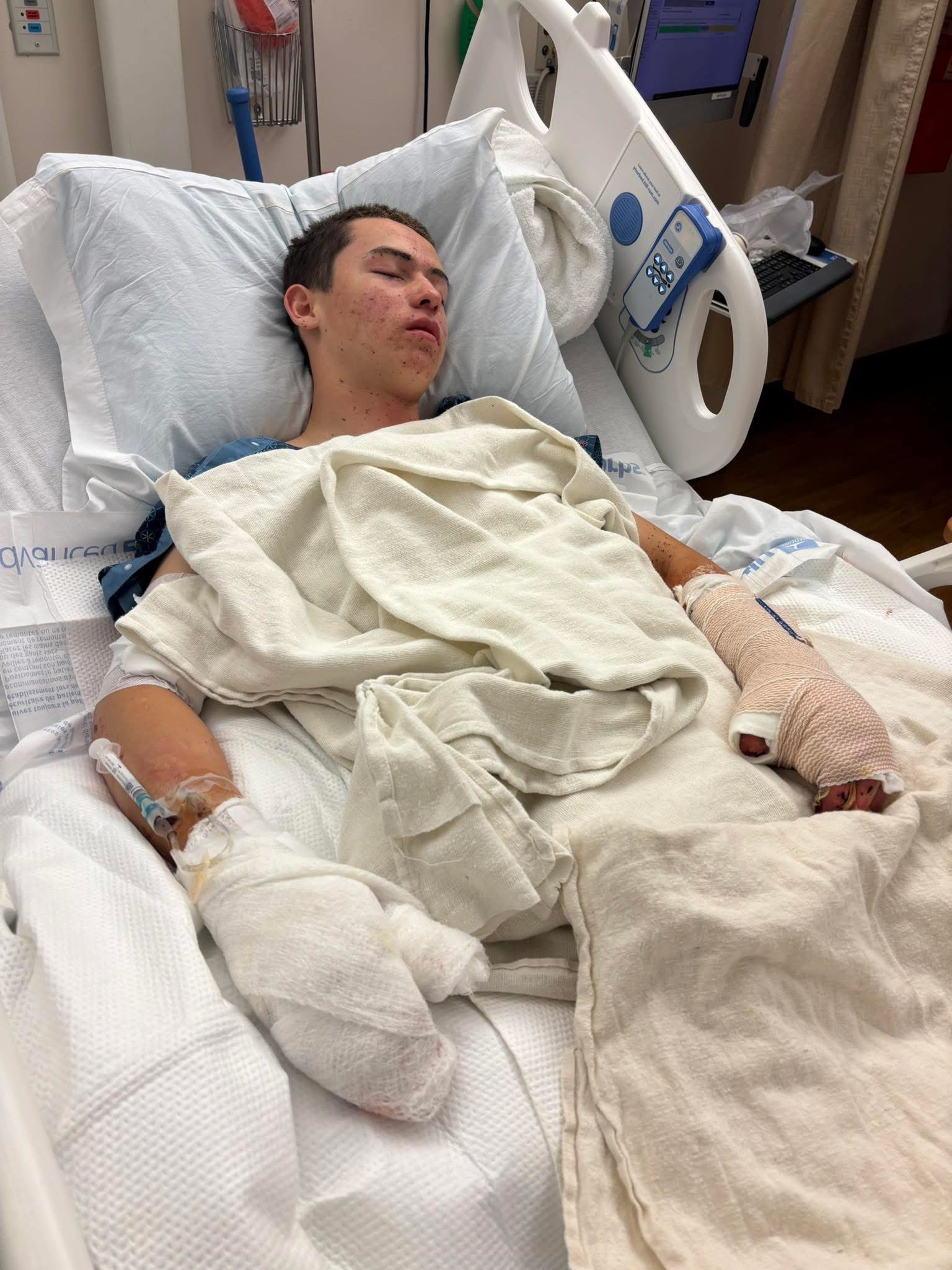 Help Anthony Recover After Devastating Firework Accident campaign photo, 2 of 8