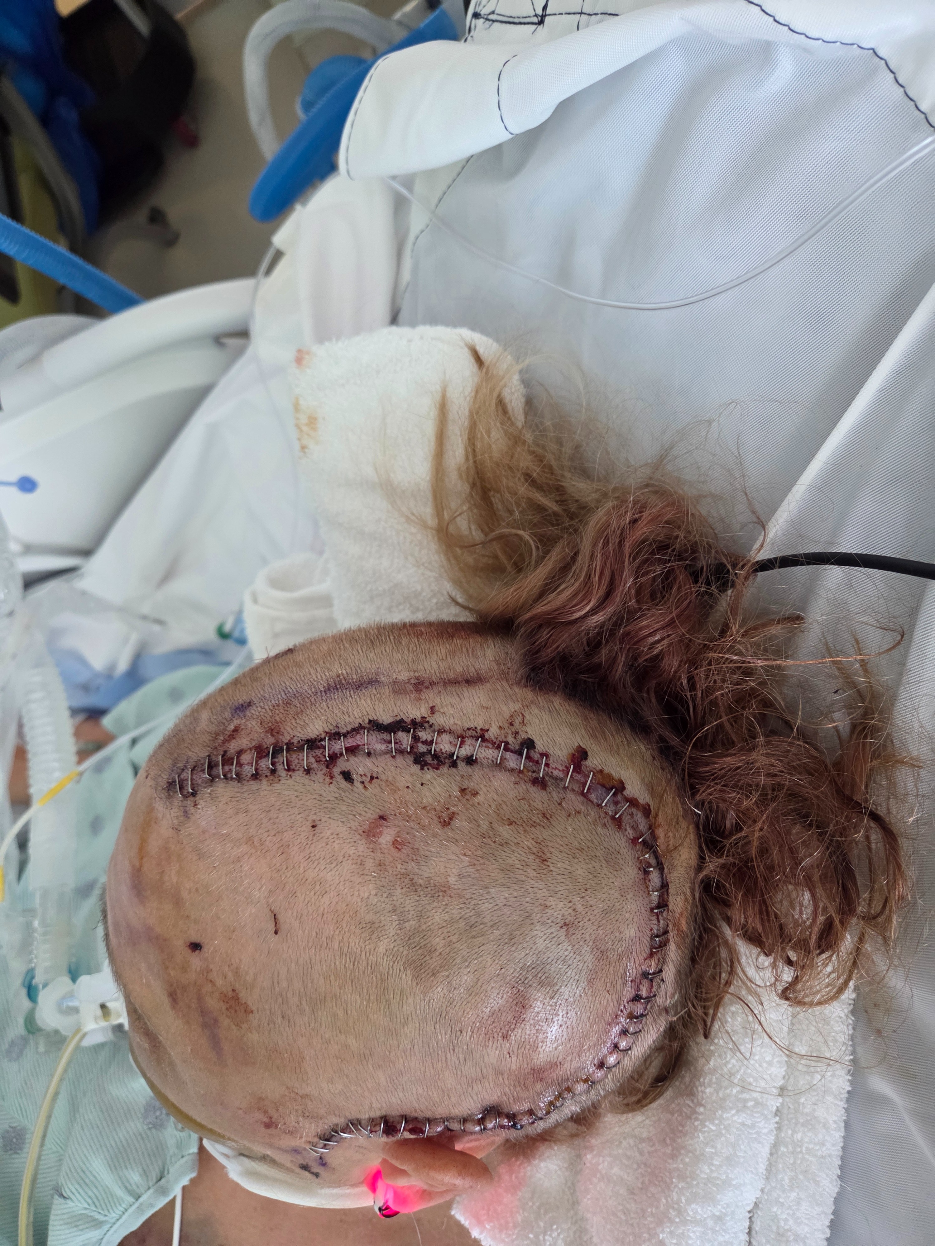Support Haley's Mom's Recovery Journey campaign photo, 2 of 8