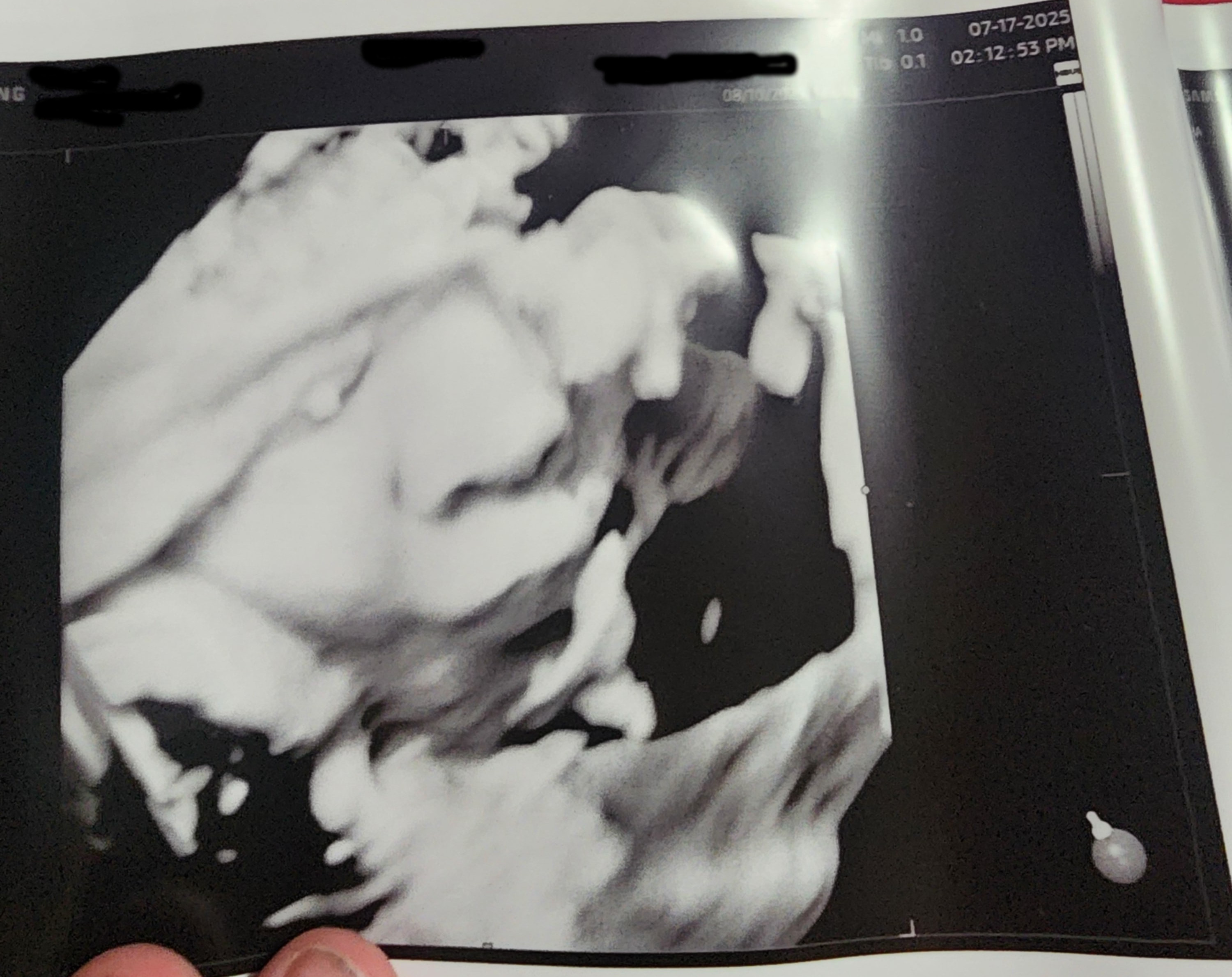 Help Arkyn's Family Through This Possible Heartbreaking Time campaign photo, 5 of 8