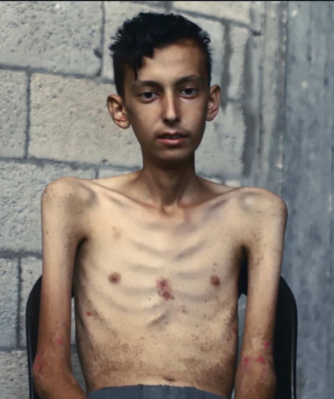 صندوق تذكاري لعائلة أحمد في غزة  Support Ahmed’s Family campaign photo, 5 of 6