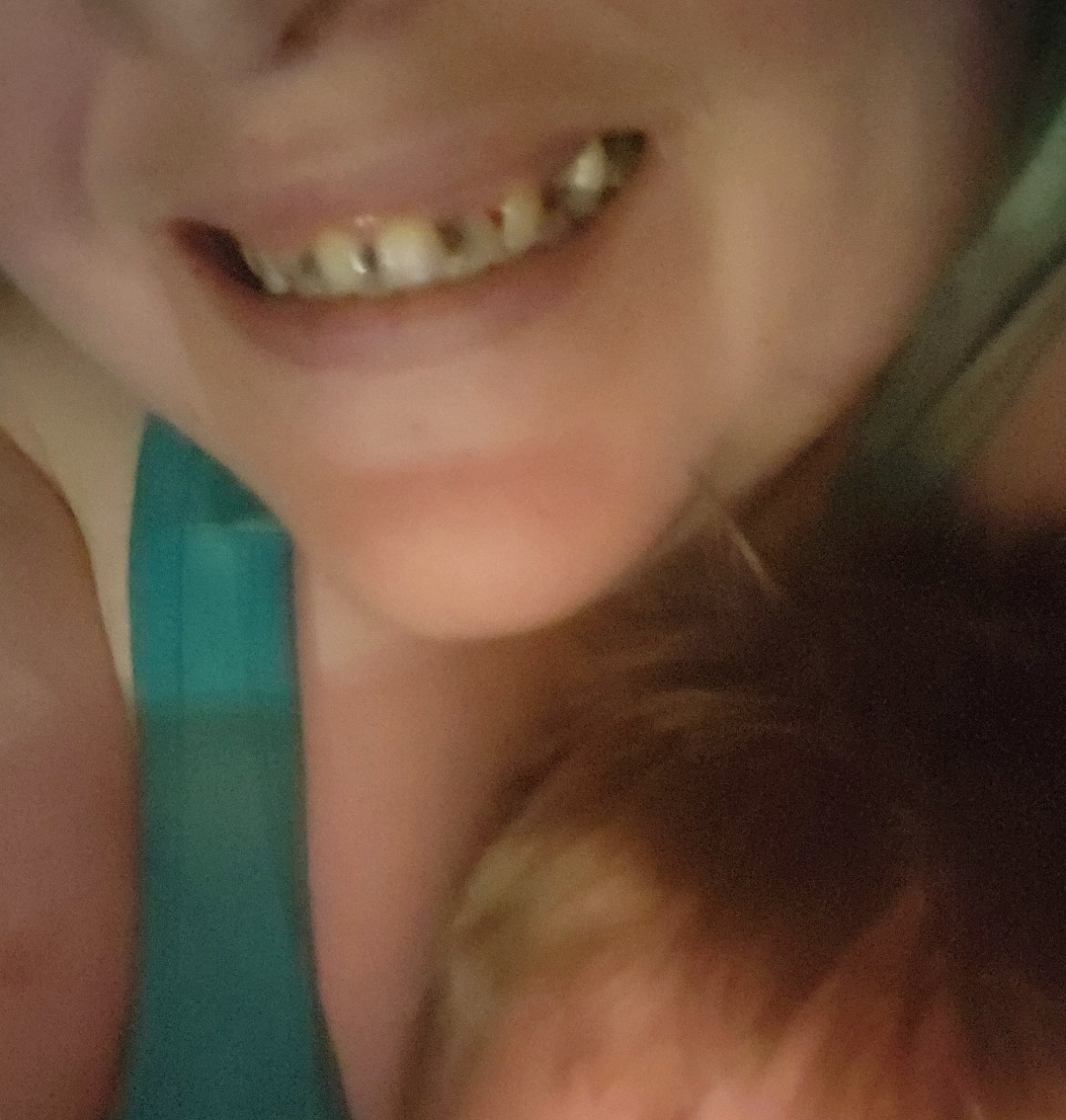 Support Needed for Life-Changing Dentures campaign photo, 2 of 5