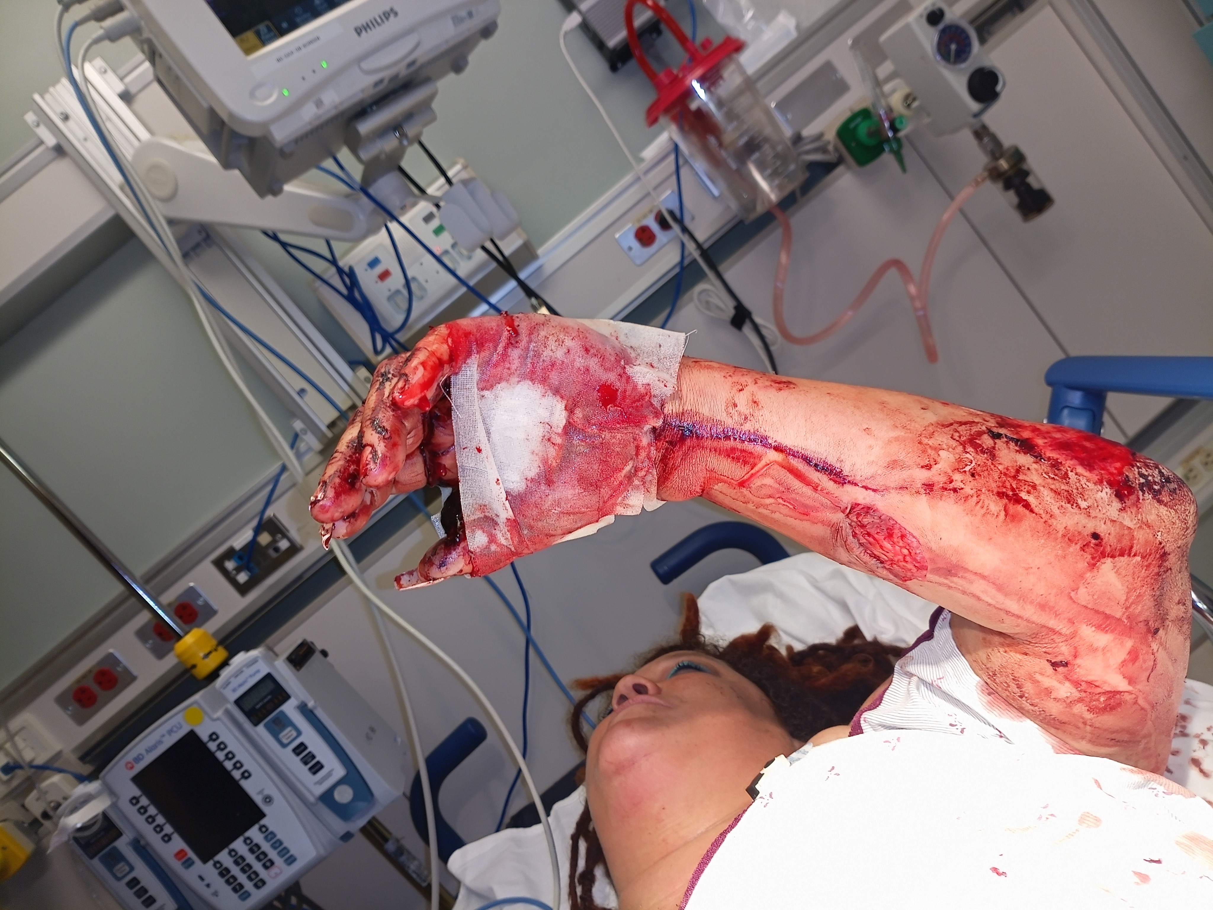 Help charity get surgery campaign photo, 5 of 8