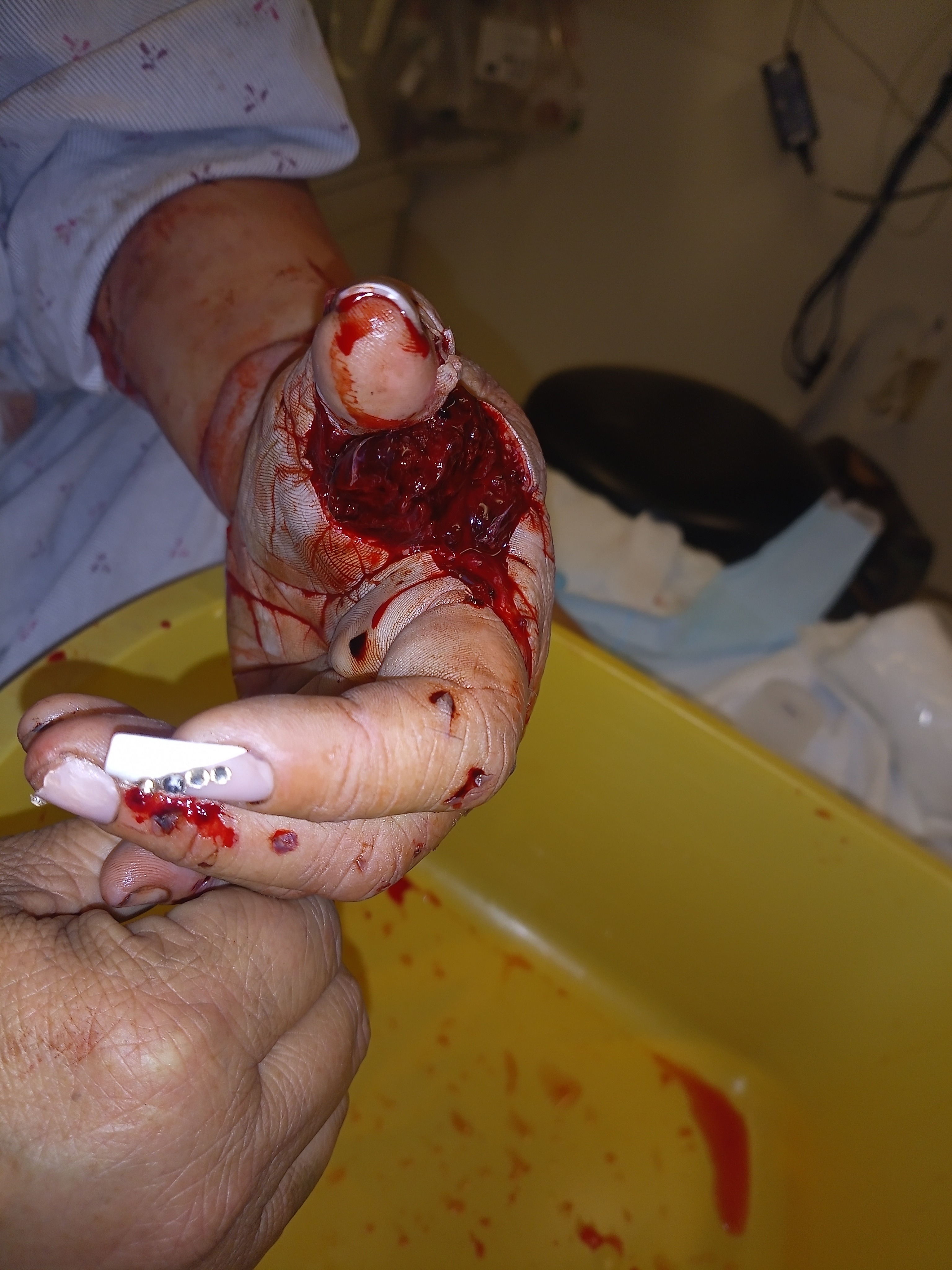 Help charity get surgery campaign photo, 6 of 8